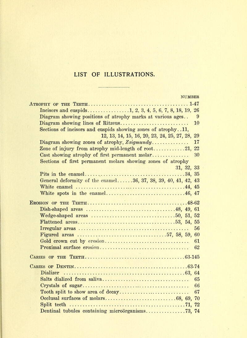 LIST OF ILLUSTRATIONS. NUMBER Atrophy op the Teeth 1-47 Incisors and cuspids 1, 2, 3, 4, 5, 6, 7, 8, 18, 19, 26 Diagram showing positions of atrophy marks at various ages. . 9 Diagram showing lines of Ritzeus 10 Sections of incisors and cuspids showing zones of atrophy. .11, 12, 13, 14, 15, 16, 20, 23, 24, 25, 27, 28, 29 Diagram showing zones of atrophy, Zsigmundy 17 Zone of injury from atrophy mid-length of root 21, 22 Cast showing atrophy of first permanent molar 30 Sections of first permanent molars showing zones of atrophy 31, 32, 33 Pits in the enamel 34, 35 General deformity of the enamel 36, 37, 38, 39, 40, 41, 42, 43 White enamel 44, 45 White spots in the enamel 46, 47 Erosion of the Teeth 48-62 Dish-shaped areas 48, 49, 61 Wedge-shaped areas 50, 51, 52 Flattened areas 53, 54, 55 Irregular areas 56 Figured areas 57, 58, 59, 60 Gold crown cut by erosion 61 Proximal surface erosion 62 Caries of the Teeth 63-145 Caries op Dentin i 63-74 Dializer 63, 64 Salts dialized from saliva 65 Crystals of sugar 66 Tooth split to show area of decay 67 Occlusal surfaces of molars 68, 69, 70 Split teeth 71, 72 Dentinal tubules containing microorganisms 73, 74