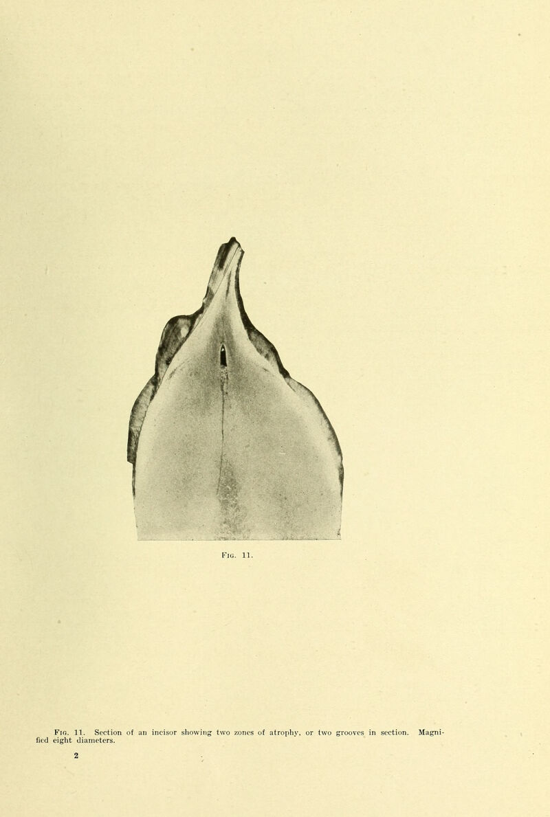 iMU. 11. Fig. 11. Section of an incisor showing two zones of atrophy, or two grooves in section. Magni- fied eight diameters. 2