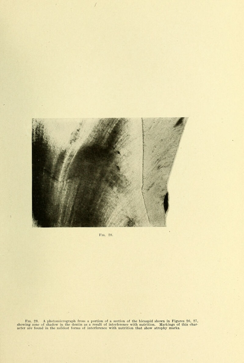 Fig. 28. A photomicrograph from a portion of a section of the bicuspid shown in Figures 26, 27, showing zone of shadow in the dentin as a result of interference with nutrition. Marlsings of this char- acter are found in the mildest forms of interference with nutrition that show atrophy marlis.