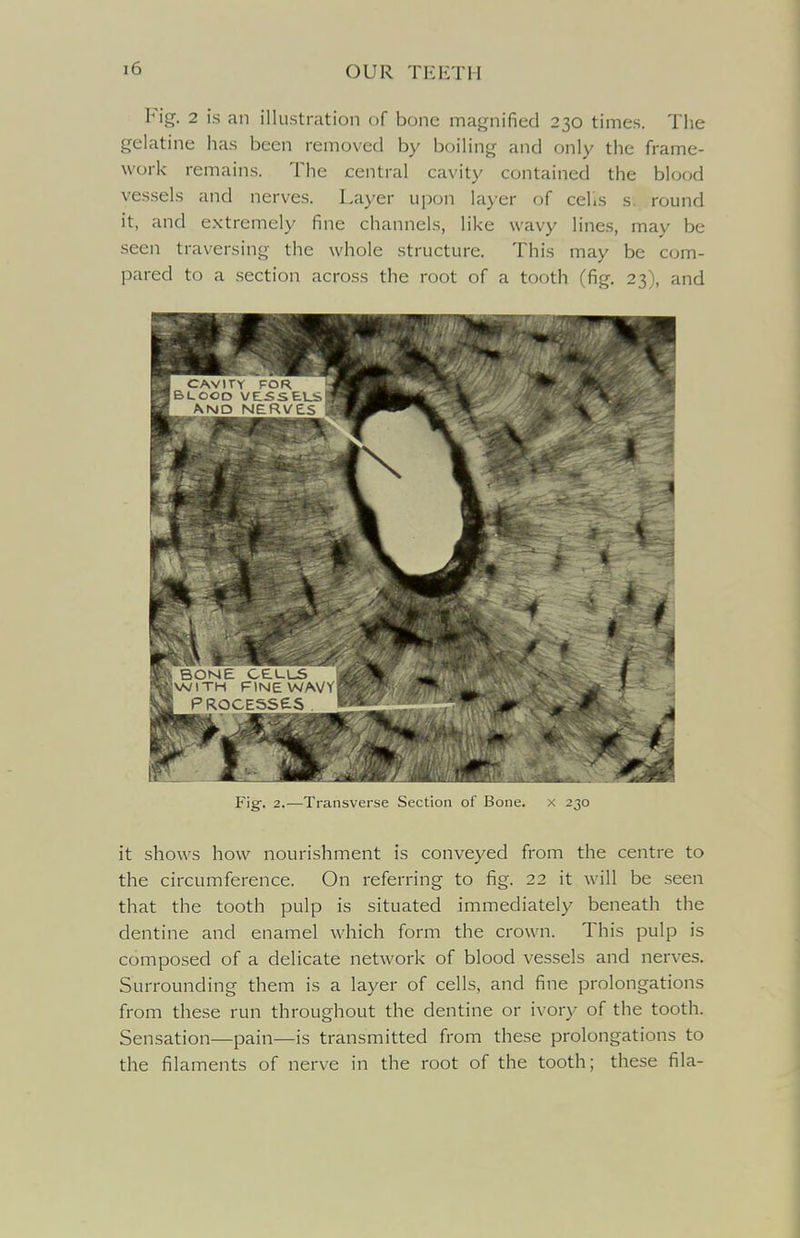 Fig. 2 is an illustration of bone magnified 230 times. The gelatine has been removed by boiling and only the frame- work remains. The central cavity contained the blood vessels and nerves. Layer upon layer of celis s. round it, and extremely fine channels, like wavy lines, may be seen traversing the whole structure. This may be com- pared to a section across the root of a tooth (fig. 23), and F']g. 2.—Transverse Section ot Bone. it shows how nourishment is conveyed from the centre to the circumference. On referring to fig. 22 it will be seen that the tooth pulp is situated immediately beneath the dentine and enamel which form the crown. This pulp is composed of a delicate network of blood vessels and nerves. Surrounding them is a layer of cells, and fine prolongations from these run throughout the dentine or ivory of the tooth. Sensation—pain—is transmitted from these prolongations to the filaments of nerve in the root of the tooth; these fila-