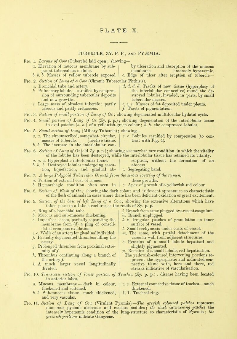 TUBERCLE, ZY. P. P., and PYEMIA. Fig. 1. Larynx of Cow (Tubercle) laid open ; showing- a. Elevation of mucous membrane by sub- jacent tuberculous nodules. b. b. b. Masses of yellow tubercle exposed by ulceration and absorption of the mucous membrane. [intensely hyperjemic. c. Edge of ulcer after eruption of tubercle— Fig. 2. Section of Lung of a Cow (Chronic Tubercular Phthisis). a. Bronchial tube and artery. b. Pulmonary lobule,—carnified by compres- sion of surrounding tubercular deposits and new growths. c. Large mass of obsolete tubercle ; partly caseous and partly cretaceous. d. d. d. d. Tracks of new tissue (hyperplasy of the interlobular connective) round the de- stroyed lobules, invaded, in parts, by small tubercular masses. e. e. e. Masses of fat deposited under pleura. /. Tracts of pigmentation. Fig. 3. Section of small portion of Lung of Ox; showing degenerated multilocular hydatid cysts. Fig. 4. Small iwrtion of Lung of Ox (Zy. p. p.); showing degeneration of the interlobular tissue in oval patches (a. a.) of a yellowish-green colour ; b. b. the compressed lobules. Fig. 5. Small section of Lung (Miliary Tubercle); showing— a. a. The circumscribed, somewhat circular, masses of tubercle. [nective tissue. b. h. The increase in the interlobular con- c. c Lobules carnified by compression (to con- trast with Fig. 4). Fig, 6. Section of Lung of Ox (old Zy. p. p.); showing a somewhat rare condition, in which the vitality of the lobules has been destroyed, while the interlobular tissue has retained its vitality. a. a. a. Hyperplastic interlobular tissue. b. b. b. Destroyed lobules undergoing casea- tion, liquefaction, and gradual ab- sorption, without the formation of an abscess, c. Segregating band. Fig. 7. A large Polypoid Tubercular Groivth from the serous covering of the rumen. a. Portion of external coat of rumen. I these growths. b. Hfemorrhagic condition often seen in | c. Apex of growth of a yellowish-red colour. Fig. 8. Section of Flesh of Ox; showing the dark colour and iridescent appearance so characteristic of the flesh of animals in cases where there has been deficient oxidation or great excitement. Fig. 9. Section of the base of left Lung of a Cow; showing the extensive alterations which have taken place in all the structures as the result of Zy. p. p. j. Branch from same plugged byarecentcoagulum. n. Branch unplugged. h. h. Irregular patches of granulation on inner surface of vessel. I. Small ecchymosis under coats of vessel, m. The same, with partial detachment of the vascular wall from adjacent structures. 0. Remains of a small lobule hepatised and slightly pigmented. p. Remains of a small lobule, red hepatisation. The yellowish-coloured interveniag portions re- present the hyperplastic and indurated con- nective tissue with, here and there, red streaks indicative of vascularisation. Fig. 10. Transverse section of lower portion of Trachea (Zy. p. p.) ; disease having been located in anterior lobes. c. c. External connective tissue of trachea—much thickened. 1.1. Tracheal ring. a. Ring of a bronchial tube. b. Mucous and sub-mucous thickening. c. Imperfect chasm, partially separating the membrane from (d) a plug of consoli- dated croupous exudation. e. e. Walls of an artery longitudinally divided. /. Partially degenerated thrombus filling the artery. g. Prolonged thrombus from proximal extre- mity of/. h. Thrombus continuing along a branch of the artery/. i. A much larger vessel longitudinally divided. a. Mucous membrane — dark in colour, thickened and softened. b. b. Sub-mucous tissue—much thickened, and very vascular. Fig. 11. Section of Lung of Coio (Virulent Pya?mia).—Tlie greijish coloured patches represent numerous pysemic abscesses and caseous nodules; the dark intervening patches the intensely hypersemic condition of the lung-structure so characteristic of Pyaemia ; the greenish portions indicate Gangrene.