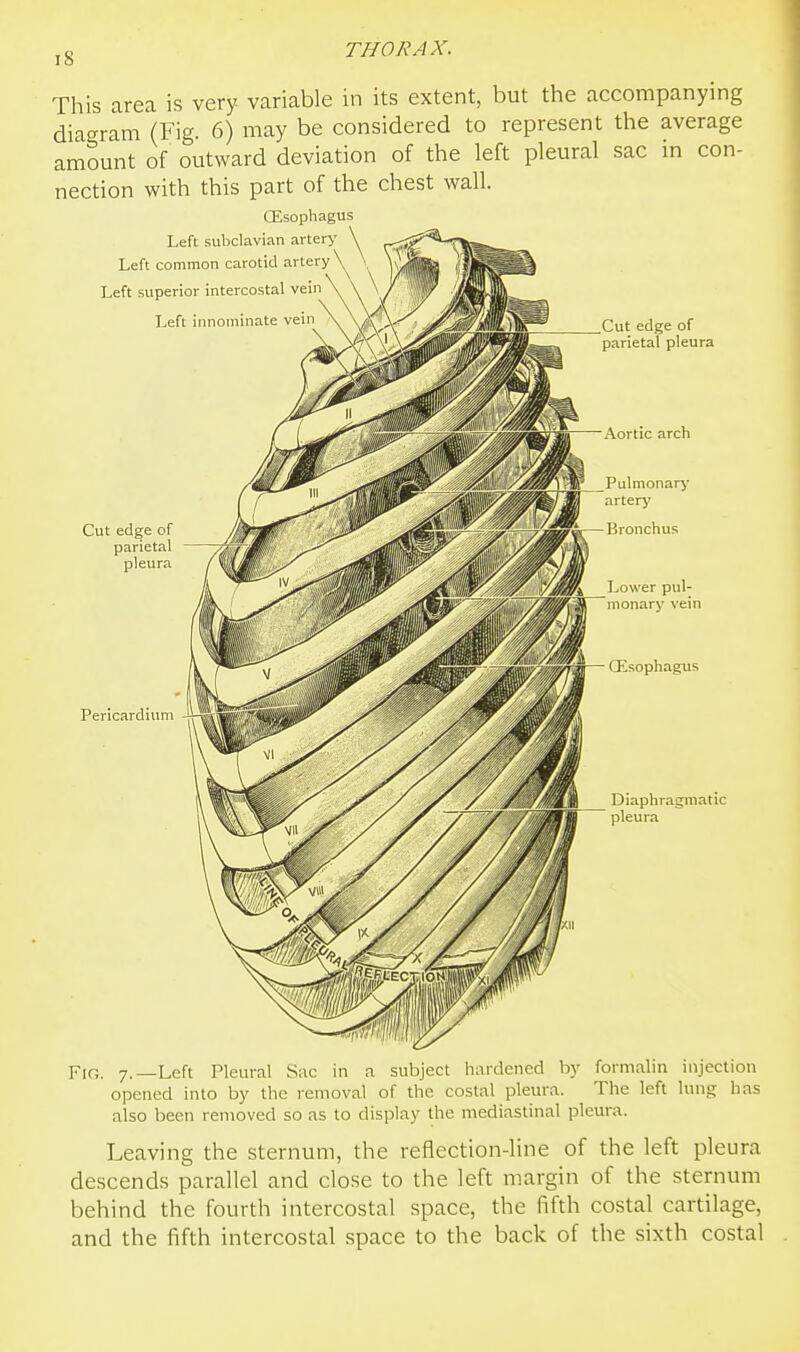 This area is very variable in its extent, but the accompanying diagram (Fig. 6) may be considered to represent the average amount of outward deviation of the left pleural sac m con- nection with this part of the chest wall. oesophagus Left subclavian artery Left common carotid artery Left superior intercostal vein Left innominate vein Cut edge of parietal pleura .Cut edge of parietal pleura Aortic arch Pulmonary artery Bronchus Pericardium Diaphragmatic pleura Fig. 7.—Left Pletiral Sac in a subject hardened by formalin injection opened into by the removal of the costal plem-a. The left lung has also been removed so as to display the mediastinal pleura. Leaving the sternum, the reflection-line of the left pleura descends parallel and close to the left margin of the sternum behind the fourth intercostal space, the fifth costal cartilage, and the fifth intercostal space to the back of the sixth costal