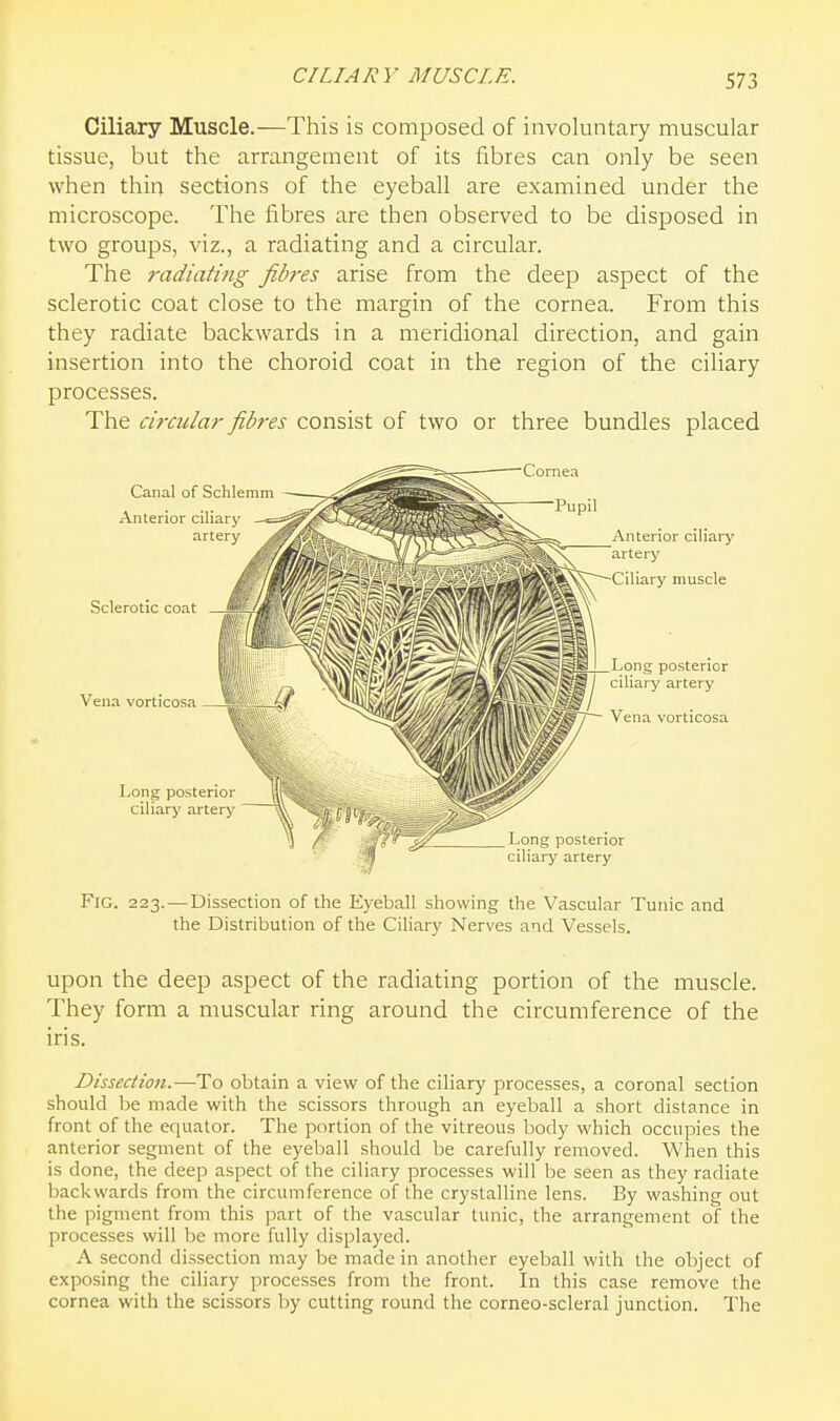 CILIARY MUSCLE. Ciliary Muscle.—This is composed of involuntary muscular tissue, but the arrangement of its fibres can only be seen when thin sections of the eyeball are examined under the microscope. The fibres are then observed to be disposed in two groups, viz., a radiating and a circular. The radiating fibres arise from the deep aspect of the sclerotic coat close to the margin of the cornea. From this they radiate backwards in a meridional direction, and gain insertion into the choroid coat in the region of the ciliary processes. The circular fibres consist of two or three bundles placed Fig. 223.—Dissection of the Eyeball showing the Vascular Tunic and the Distribution of the Ciliary Nerves and Vessels. upon the deep aspect of the radiating portion of the muscle. They form a muscular ring around the circumference of the iris. Dissection.—To obtain a view of the ciliary processes, a coronal section should be made with the scissors through an eyeball a short distance in front of the equator. The portion of the vitreous body which occupies the anterior segment of the eyeball should be carefully removed. When this is done, the deep aspect of the ciliary processes will be seen as they radiate backwards from the circumference of the crystalline lens. By washing out the pigment from this ]iart of the vascular tunic, the arrangement of the processes will be more fully displayed. A second dissection may be made in another eyeball with the object of exposing the ciliary processes from the front. In this case remove the cornea with the scissors by cutting round the corneo-scleral junction. The