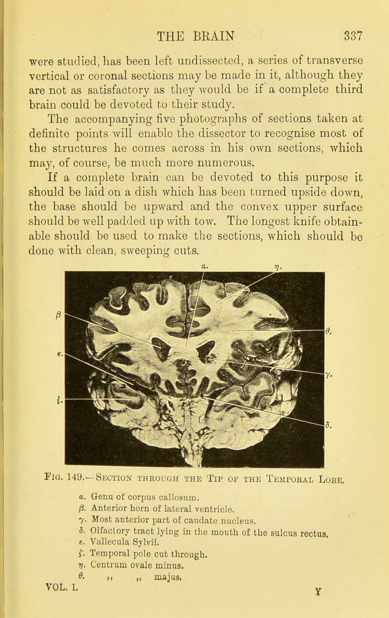 ■were studied, has been left undissected, a series of transverse vertical or coronal sections may be made in it, although they are not as satisfactory as they would be if a complete third brain could be devoted to their study. The accompanying five photographs of sections taken at definite points will enable the dissector to recognise most of the structures he comes across in his own sections, which may, of course, be much more numerous. If a complete brain can be devoted to this purpose it should be laid on a dish which has been turned upside down, the base should be upward and the convex upper surface should be well padded up with tow. The longest knife obtain- able should be used to make the sections, which should be done with clean, sweeping cuts. Fig. 149.—Section through the Tip of the Temporal Lobe. a. Genu of corpus callosum. p. Anterior horn of lateral ventricle. 7. Most anterior part of caudate nucleus. 5. Olfactory tract lying in the mouth of the sulcus rectus, e. Vallecula Sylvii. t. Temporal pole cut through. 17. Centrum ovale minus. ff- M ,1 majus, VOL. I. V