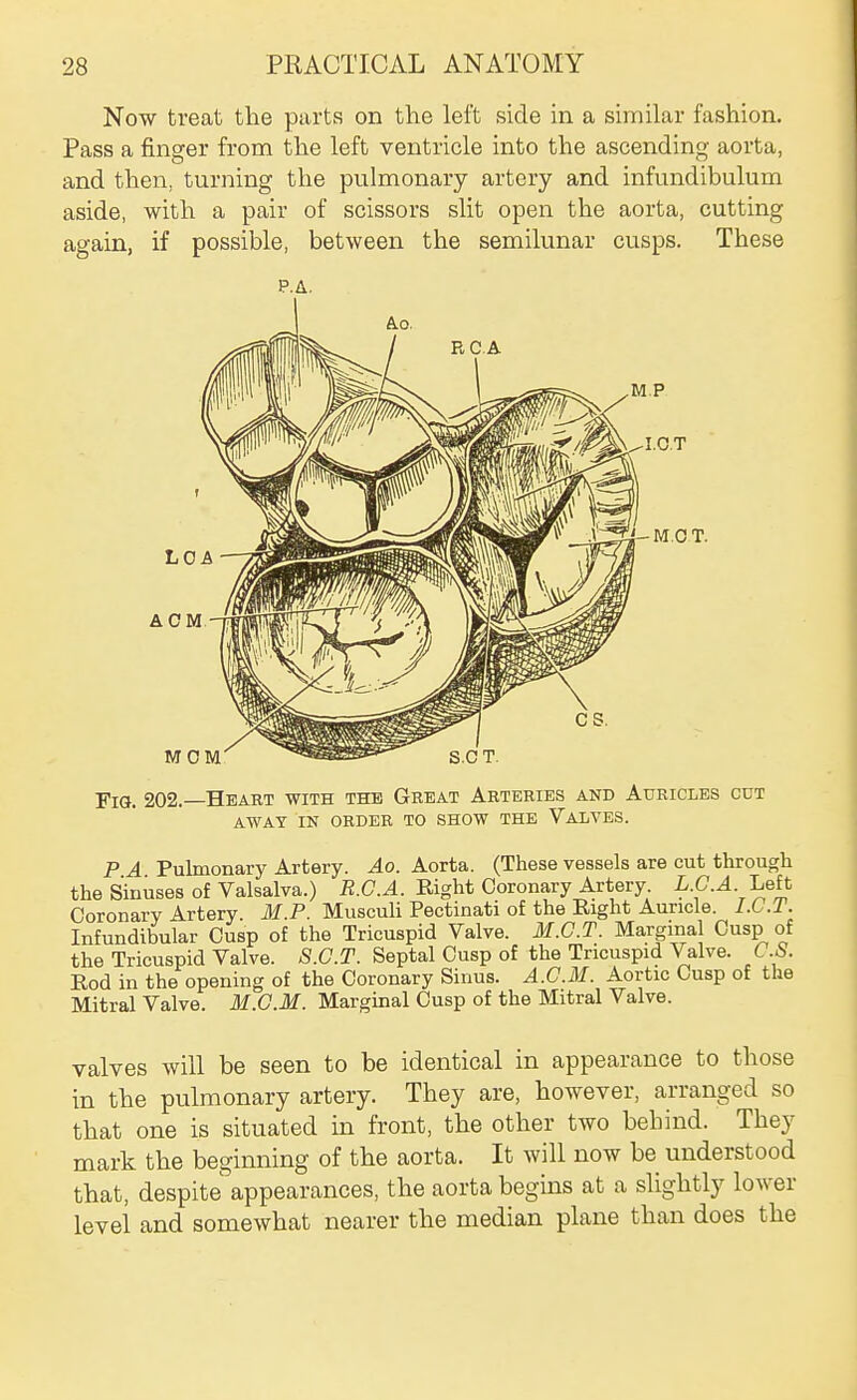 Now treat the parts on the left side in a similar fashion. Pass a finger from the left ventricle into the ascending aorta, and then, turning the pulmonary artery and infundibulum aside, with a pair of scissors slit open the aorta, cutting again, if possible, between the semilunar cusps. These P.A. A.O. Fig. 202.—Heart with the Great Arteries and Auricles cut AWAY IN ORDER TO SHOW THE VaLVES. P A Pulmonary Artery. Ao. Aorta. (These vessels are cut through the Sinuses of Valsalva.) R.C.A. Right Coronary Artery. L.C.A. Left Coronary Artery M.P. Musculi Pectinati of the Eight Auricle. I.C.T. Infundibular Cusp of the Tricuspid Valve. M.G.T. Marginal Cusp of the Tricuspid Valve. S.G.T. Septal Cusp of the Tricuspid Valve. C.S. Eod in the opening of the Coronary Sinus. A.G.M. Aortic Cusp of the Mitral Valve. M.C.M. Margmal Cusp of the Mitral Valve. valves will be seen to be identical in appearance to those in the pulmonary artery. They are, however, arranged so that one is situated in front, the other two behind. They mark the beginning of the aorta. It will now be understood that, despite appearances, the aorta begins at a slightly lower level and somewhat nearer the median plane than does the