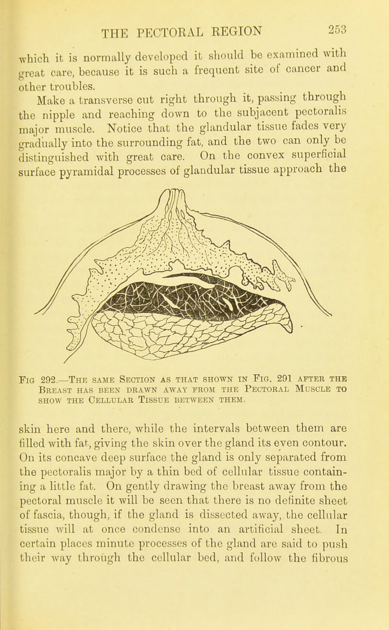 which it is normally developed it should be examined with great care, because it is such a frequent site of cancer and other troubles. Make a transverse cut right through it, passing through the nipple and reaching down to the subjacent pectoralis major muscle. Notice that the glandular tissue fades very gradually into the surrounding fat, and the two can only be distinguished with great care. On the convex superficial surface pyramidal processes of glandular tissue approach the Fig 292.—The same Section as that shown in Fig. 291 after the Breast has been drawn away prom the Pectoral Muscle to SHOW the Cellular Tissue between them. skin here and there, while the intervals between them are fdled with fat, giving the skin over the gland its even contour. On its concave deep surface the gland is only separated from the pectoralis major by a thin bed of cellular tissue contain- ing a little fat. On gently drawing the breast away from the pectoral muscle it will be seen that there is no definite sheet of fascia, though, if the gland is dissected away, the cellular tissue Avill at once condense into an artificial sheet. In certain places minute processes of the gland are said to push their way through the cellular bed, and follow the fibrous