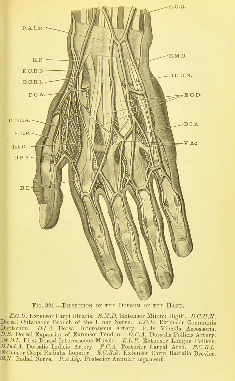 Fig. 321.—Dissection of the Doksum of the Hand. E.C.U. Extensor Carpi Ulnaris. E.M.D. Extensor Minimi Digiti. B.C.U.N. Dorsal Cutaneous Branch of the Uhiar Nerve. E.C.D. Extensor Communis Digitorum. D.I.A. Dorsal Interosseus Artery. V.Ac. Vincula Accessoria. B.IS. Dorsal Expansion of Extensor Tendon. D.P.A. Dorsalis Pollicis Artery. 1st D.I. First Dorsal Interosseous Muscle. E.L.P. Extensor Longus Pollicis. D.Ind.A. Dorsalis Indicis Artery. P.C.A. Posterior Carpal Arch. E.C.B.L. ■Extensor Carpi Radialis Longior. E.C.R.B. Extensor Carpi Radialis Brevior. tR.N. Radial Nerve. P.A.Lig. Posterior Annular Ligament.