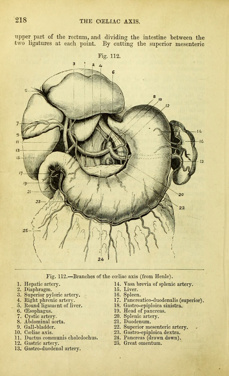 upper part of the rectum, and dividing the intestine between the two ligatures at each point. By cutting the superior mesenteric Fig. 112. Fig. 112.—Branches of the cccliac axis (from Henle). 1. Hepatic artery. 2. Diaphragm. 3. Superior pyloric artery. 4. Right phrenic artery. .5. Round ligament of liver. 6. (Esophagus. 7. Cystic artery. 8. Abdominal aorta. 9. Gall-bladder. 10. Coeliae axis. 11. Ductus communis choledochus. 12. Gastric artery. 13. Gastro-duodenal artery. 14. Yasa brevia of splenic artery. 15. Liver. 16. Spleen. 17. Pancreatico-duodenalis (superior). 18. Gastro-epiploica sinistra. 19. Head of pancreas. 20. Splenic artery. 21. Duodenum. 22. Superior mesenteric artery. 23. Gastro-epiploica dextra. 24. Pancreas (drawn down). 25. Great omentum.