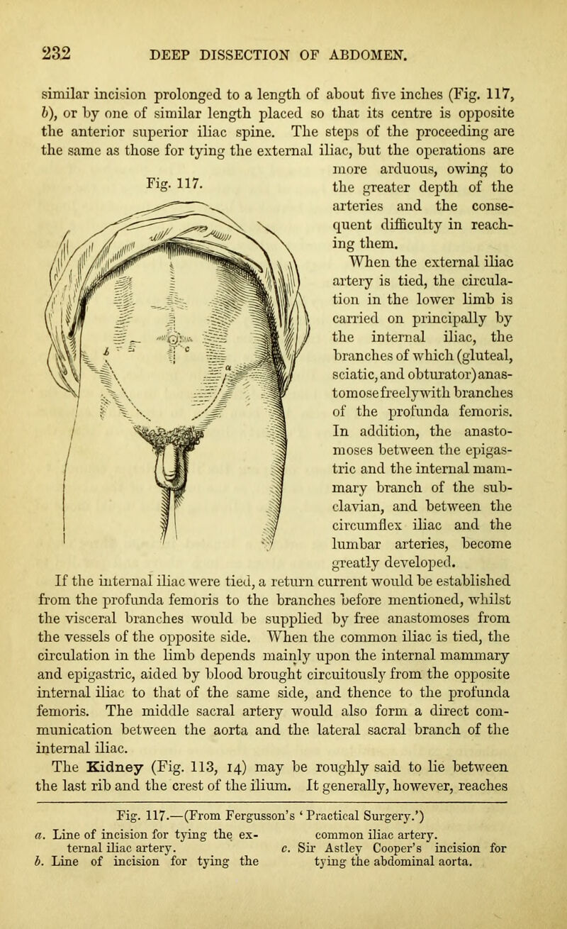 similar incision prolonged to a length of about five inches (Fig. 117, b), or by one of similar length placed so that its centre is opposite the anterior superior iliac spine. The steps of the proceeding are the same as those for tying the external iliac, but the operations are more arduous, owing to the greater depth of the arteries and the conse- quent difficulty in reach- ing them. When the external iliac artery is tied, the circula- tion in the lower limb is carried on principally by the internal iliac, the branches of which (gluteal, sciatic, and obturator) anas- tomose freely with branches of the profunda femoris. In addition, the anasto- moses between the epigas- tric and the internal mam- mary branch of the sub- clavian, and between the circumflex iliac and the lumbar arteries, become greatly developed. If the internal iliac were tied, a return current would be established from the profunda femoris to the branches before mentioned, whilst the visceral branches would be supplied by free anastomoses from the vessels of the opposite side. When the common iliac is tied, the circulation in the limb depends mainly upon the internal mammary and epigastric, aided by blood brought circuitously from the opposite internal iliac to that of the same side, and thence to the profunda femoris. The middle sacral artery would also form a direct com- munication between the aorta and the lateral sacral branch of the internal iliac. The Kidney (Fig. 113, 14) may be roughly said to lie between the last rib and the crest of the ilium. It generally, however, reaches Fig. 117.—(From Fergusson’s ‘Practical Surgery.’) a. Line of incision for tying the ex- common iliac artery. ternal iliac artery. c. Sir Astley Cooper’s incision for b. Line of incision for tying the tying the abdominal aorta.