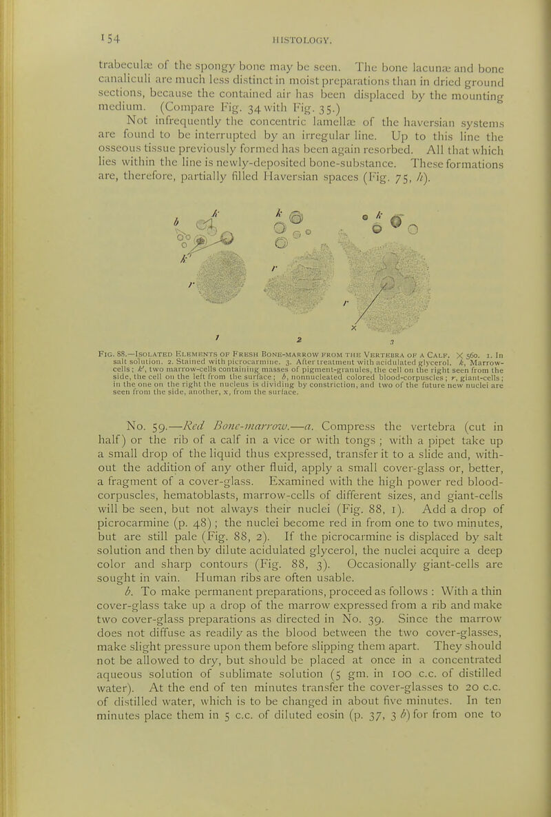 trabecula; of the spongy bone may be seen. The bone lacuna; and bone canaliculi are much less distinct in moist preparations than in dried ground sections, because the contained air has been disiilaced by the mounting medium. (Compare Fig. 34 with I'^ig. 35.) Not infrequently the concentric lamella; of the haversian systems are found to be interrupted by an irregular line. Up to this line the osseous tissue previously formed has been again resorbed. All that which lies within the line is newly-deposited bone-substance. These formations are, therefore, partially filled Haversian spaces (Fig. 75, h). .7 Fig. 88.—Isolated Elements of Fresh Bone-marrow from the Vertebra ok a Calf. X 560. i. In salt soUuioii. 2. Slaiiied with pici'ocarniine. 3. After treatmeiit with acidulated glycerol, /t, Marrow- cells; k', two marrow-cells containing masses of pigment-granules, the cell on the right seen from the side, the cell on the left from the surface; A, nonnucleated colored blood-corpuscles; r, giant-cells; in the one on the right the nucleus is dividing by constriction, and two of the future new nuclei are seen from the side, another, x, from the surface. No. 59.—Red Bonc-inarrozv.—a. Compress the vertebra (cut in half) or the rib of a calf in a vice or with tongs ; with a pipet take up a small drop of the liquid thus expressed, transfer it to a slide and, with- out the addition of any other fluid, apply a small cover-glass or, better, a fragment of a cover-glass. Examined with the high power red blood- corpuscles, hematoblasts, marrow-cells of different sizes, and giant-cells will be seen, but not always their nuclei (Fig. 88, i). Add a drop of picrocarmine (p. 48); the nuclei become red in from one to two minutes, but are still pale (Fig. 88, 2). If the picrocarmine is displaced by salt solution and then by dilute acidulated glycerol, the nuclei acquire a deep color and sharp contours (Fig. 88, 3). Occasionally giant-cells are sought in vain. Human ribs are often usable. b. To make permanent preparations, proceed as follows : With a thin cover-glass take up a drop of the marrow expressed from a rib and make two cover-glass preparations as directed in No. 39. Since the marrow does not diffuse as readily as the blood between the two cover-glasses, make slight pressure upon them before slipping them apart. They should not be allowed to dry, but should be placed at once in a concentrated aqueous solution of sublimate solution (5 gm. in 100 c.c. of distilled water). At the end of ten minutes transfer the cover-glasses to 20 c.c. of distilled water, which is to be changed in about five minutes. In ten minutes place them in 5 c.c. of diluted eosin (p. 37, 3 /;) for from one to