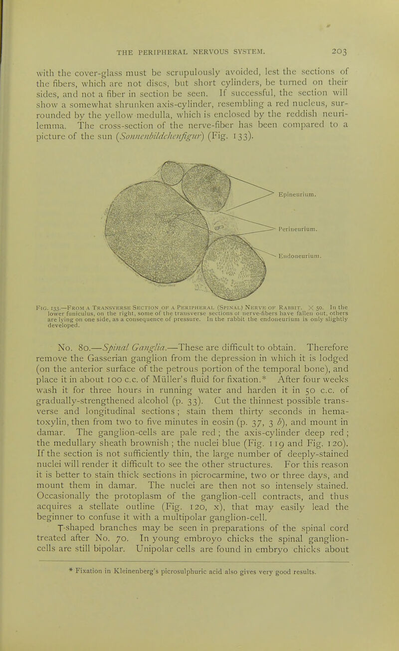 w ith the cover-glass must be scrupulously avoided, lest the sections of the fibers, which are not discs, but short cylinders, be turned on their sides, and not a fiber in section be seen. If successful, the section will show a somewhat shrunken a.xis-cylinder, resembling a red nucleus, sur- rounded by the yellow medulla, which is enclosed by the reddish neuri- lemma. The cross-section of the nerve-fiber has been compared to a picture of the sun {So)iuciibildchciifigin^ (F'g- ^SS)- Epitieuriiim. Perineurium. EiKloiieuriuni. Fig. 133.—From k TransviiKSE Section oe a Peripheral (Spi.val) Nerve of Rabbit. X 50. In tlie lower funiculus, on tlie right, some of ilie transverse sections ol nerve-fibers have fallen out, others are lying on one side, as a consequence of pressure. In the rabbit the endoneurium is only slightly developed. No. 80.—Spinal Ganglia.—These are difficult to obtain. Therefore remove the Gasserian ganglion from the depression in which it is lodged (on the anterior surface of the petrous portion of the temporal bone), and place it in about lOO c.c. of Miiller's fluid for fixation.* After four weeks wash it for three hours in running water and harden it in 50 c.c. of gradually-strengthened alcohol (p. 33). Cut the thinnest possible trans- verse and longitudinal sections ; stain them thirty seconds in hema- toxylin, then from two to five minutes in eosin (p. 37, 3 U), and mount in damar. The ganglion-cells are pale red ; the axis-cylinder deep red ; the medullary sheath brownish ; the nuclei blue (Fig. 119 and Fig. 120). If the section is not sufficiently thin, the large number of deeply-stained nuclei will render it difficult to see the other structures. For this reason it is better to stain thick sections in picrocarmine, two or three days, and mount them in damar. The nuclei are then not so inten.sely stained. Occasionally the protoplasm of the ganglion-cell contracts, and thus acquires a stellate outline (Fig. 120, x), that may easily lead the beginner to confuse it with a multipolar ganglion-cell. T-shaped branches may be seen in preparations of the spinal cord treated after No. 70. In young embroyo chicks the spinal ganglion- cells are still bipolar. Unipolar cells are found in embryo chicks about * Fi.\ation in Kleinenberg's picrosulphuric acid also gives very good results.