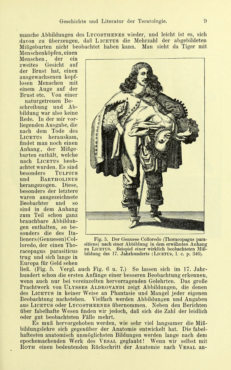 manche Abbildungen des Lycosthenes wieder, und leicht ist es, sich davon zu überzeugen, daß Licetus die Mehrzahl der abgebildeten Mißgeburten nicht beobachtet haben kann. Man sieht da Tiger mit Menschenköpfen, einen Menschen, der ein zweites Gesicht auf der Brust hat, einen ausgewachsenen kopf- losen Menschen mit einem Auge auf der Brust etc. Von einer naturgetreuen Be- schreibung und Ab- bildung war also keine Rede. In der mir vor- liegenden Ausgabe, die nach dem Tode des Licetus herauskam, findet man noch einen Anhang, der Mißge- burten enthält, welche nach Licetus beob- achtet wurden. Es sind besonders Tulpius und Bartholinus herangezogen. Diese, besonders der letztere waren ausgezeichnete Beobachter und so sind in dem Anhang zum Teil schon ganz brauchbare Abbildun- gen enthalten, so be- sonders die des Ita- lieners (Genuesen) Col- loredo, der einen Tho- racopagus parasiticus trug und sich lange in Europa für Geld sehen ließ. (Fig. 5. Vergl. auch Fig. 6 u. 7.) So lassen sich im 17. Jahr- hundert schon die ersten Anfänge einer besseren Beobachtung erkennen, wenn auch nur bei vereinzelten hervorragenden Gelehrten. Das große Prachtwerk von Ulysses Aldrovandi zeigt Abbildungen, die denen des Licetus in keiner Weise an Phantasie und Mangel jeder eigenen Beobachtung nachstehen. Vielfach werden Abbildungen und Angaben aus Licetus oder Lycosthernes übernommen. Neben den Berichten über fabelhafte Wesen finden wir jedoch, daß sich die Zahl der leidlich oder gut beobachteten Fälle mehrt. Es muß hervorgehoben werden, wie sehr viel langsamer die Miß- bildungslehre sich gegenüber der Anatomie entwickelt hat. Die fabel- haftesten anatomisch unmöglichsten Bildungen werden lange nach dem epochemachenden Werk des Vesal geglaubt! Wenn wir selbst mit Roth einen bedeutenden Rückschritt der Anatomie nach Vesal an- Fig. 5. Der Genuese CoUoredo (Thoracopagus para- siticus) nach einer Abbildung in dem erwähnten Anhang zu Licetus. Beispiel einer wirklich beobachteten Miß- bildung des 17. Jahrhunderts (Licetus, 1. c. p. 346).