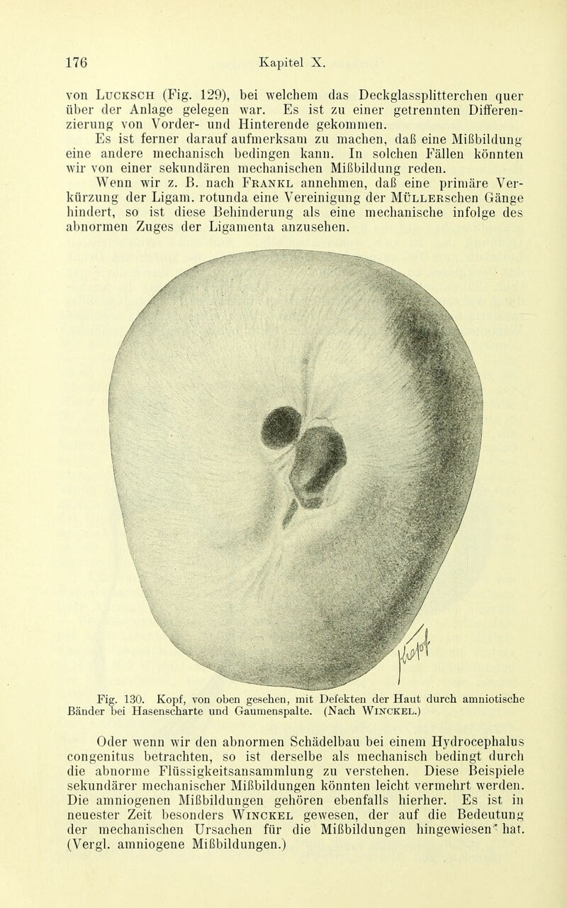 von LuCKSCH (Fig. 129), bei welchem das Deckglassplitterchen quer über der Anlage gelegen war. Es ist zu einer getrennten Differen- zierung von Vorder- und Hinterende gekommen. Es ist ferner darauf aufmerksam zu machen, daß eine Mißbildung eine andere mechanisch bedingen kann. In solchen Fällen könnten wir von einer sekundären mechanischen Mißbildung reden. Wenn wir z. ß. nach Frankl annehmen, daß eine primäre Ver- kürzung der Ligam. rotunda eine Vereinigung der MÜLLERschen Gänge hindert, so ist diese Behinderung als eine mechanische infolge des abnormen Zuges der Ligamenta anzusehen. Fig. 130. Kopf, von oben gesellen, mit Defekten der Haut durch amniotische Bänder bei Hasenscharte und Gaumenspalte. (Nach Winckel.) Oder wenn wir den abnormen Schädelbau bei einem Hydrocephalus congenitus betrachten, so ist derselbe als mechanisch bedingt durch die abnorme Flüssigkeitsansammlung zu verstehen. Diese Beispiele sekundärer mechanischer Mißbildungen könnten leicht vermehrt werden. Die amniogenen Mißbildungen gehören ebenfalls hierher. Es ist in neuester Zeit besonders Winckel gewesen, der auf die Bedeutung der mechanischen Ursachen für die Mißbildungen hingewiesen hat. (Vergl. amniogene Mißbildungen.)