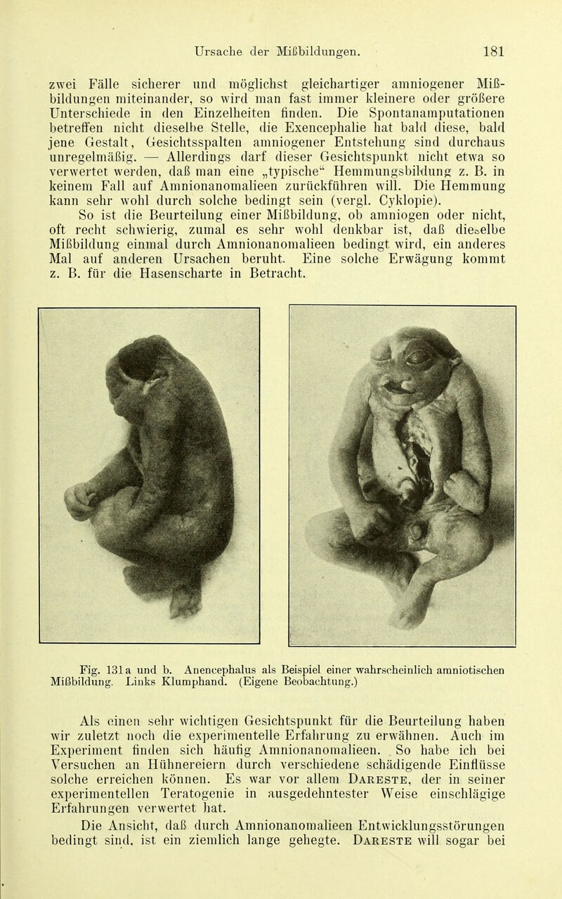 zwei Fälle sicherer und möglichst gleichartiger amniogener Miß- bildungen miteinander, so wird man fast immer kleinere oder größere Unterschiede in den Einzelheiten finden. Die Spontanamputationen betrefifen nicht dieselbe Stelle, die Exencephalie hat bald diese, bald jene Gestalt, Gesichtsspalten amniogener Entstehung sind durchaus unregelmäßig. — Allerdings darf dieser Gesichtspunkt nicht etwa so verwertet werden, daß man eine „typische Hemmungsbiklung z. B. in keinem Fall auf Amnionanomalieen zurückführen will. Die Hemmung kann sehr wohl durch solche bedingt sein (vergl. Cyklopie). So ist die Beurteilung einer Mißbildung, ob amniogen oder nicht, oft recht schwierig, zumal es sehr wohl denkbar ist, daß dieselbe Mißbildung einmal durch Amnionanomalieen bedingt wird, ein anderes Mal auf anderen Ursachen beruht. Eine solche Erwägung kommt z. B. für die Hasenscharte in Betracht. Als einen sehr wichtigen Gesichtspunkt für die Beurteilung haben wir zuletzt nocli die experimentelle Erfahrung zu erwähnen. Auch im Experiment finden sich häufig Amnionanomalieen. So habe ich bei Versuchen an Hühnereiern durch verschiedene schädigende Einflüsse solche erreichen können. Es war vor allem Dareste, der in seiner experimentellen Teratogenie in ausgedehntester Weise einschlägige Erfahrungen verwertet hat. Die Ansicht, daß durch Amnionanomalieen Entwicklungsstörungen bedingt sind, ist ein ziemlich lange gehegte. Dareste will sogar bei