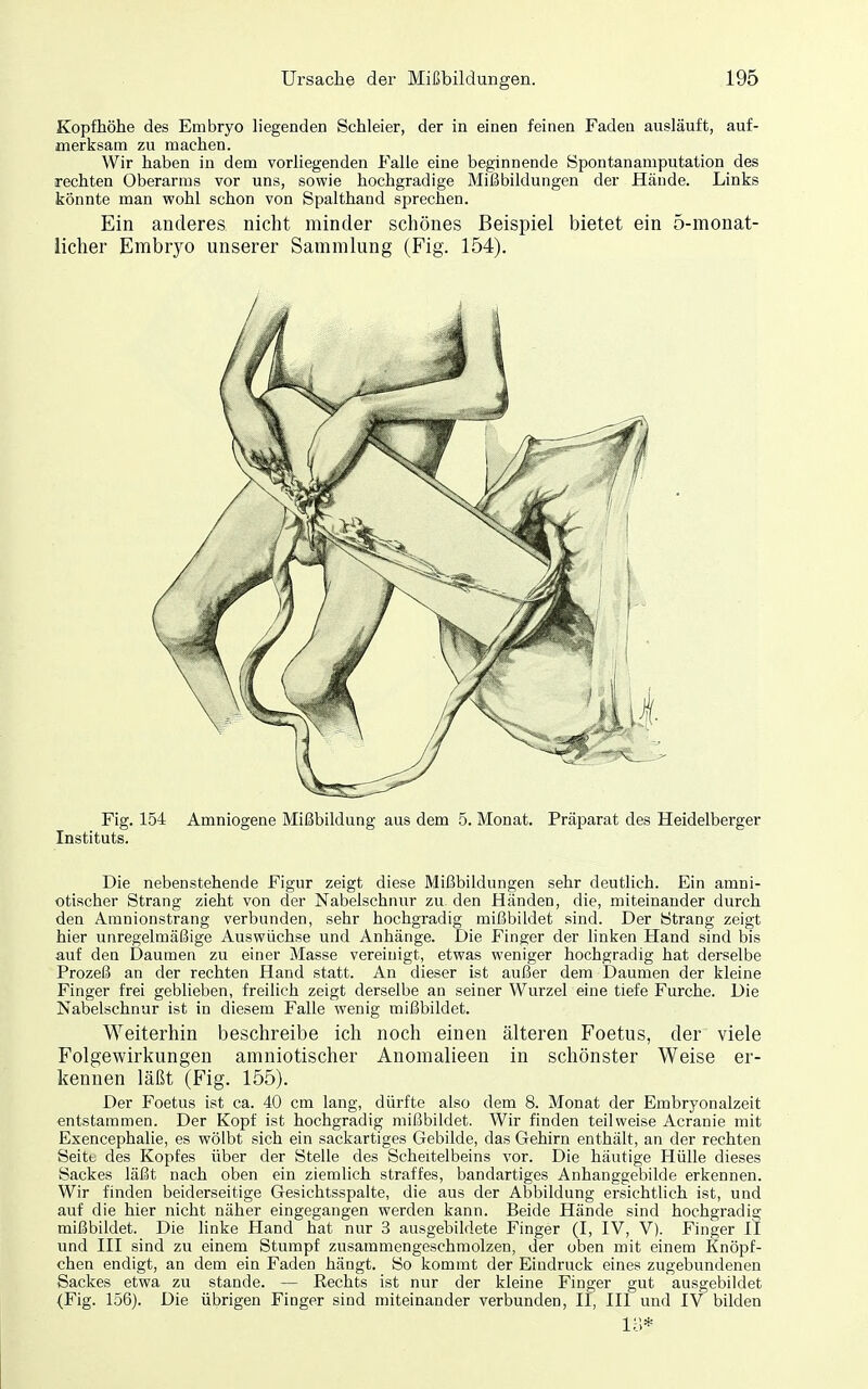 Kopfhöhe des Embryo liegenden Schleier, der in einen feinen Faden ausläuft, auf- merksam zu machen. Wir haben in dem vorliegenden Falle eine beginnende Spontanamputation des rechten Oberarms vor uns, sowie hochgradige Mißbildungen der Hände. Links könnte man wohl schon von Spalthand sprechen. Ein anderes nicht minder schönes Beispiel bietet ein 5-monat- licher Embryo unserer Sammlung (Fig. 154). Fig. 154 Amniogene Mißbildung aus dem 5. Monat. Präparat des Heidelberger Instituts. Die nebenstehende Figur zeigt diese Mißbildungen sehr deutlich. Ein amni- otischer Strang zieht von der Nabelschnur zu den Händen, die, miteinander durch den Amnionstrang verbunden, sehr hochgradig mißbildet sind. Der Strang zeigt hier unregelmäßige Auswüchse und Anhänge. Die Finger der linken Hand sind bis auf den Daumen zu einer Masse vereinigt, etwas weniger hochgradig hat derselbe Prozeß an der rechten Hand statt. An dieser ist außer dem Daumen der kleine Finger frei geblieben, freilich zeigt derselbe an seiner Wurzel eine tiefe Furche. Die Nabelschnur ist in diesem Falle wenig mißbildet. Weiterhin beschreibe ich noch einen älteren Foetus, der viele Folgewirkungen amniotischer Anomalieen in schönster Weise er- kennen läßt (Fig. 155). Der Foetus ist ca. 40 cm lang, dürfte also dem 8. Monat der Embryonalzeit entstammen. Der Kopf ist hochgradig mißbildet. Wir finden teilweise Acranie mit Exencephalie, es wölbt .sich ein sackartiges Gebilde, das Gehirn enthält, an der rechten Seitt- des Kopfes über der Stelle des Scheitelbeins vor. Die häutige Hülle dieses Sackes läßt nach oben ein ziemlich straffes, bandartiges Anhanggebilde erkennen. Wir finden beiderseitige Gesichtsspalte, die aus der Abbildung ersichtlich ist, und auf die hier nicht näher eingegangen werden kann. Beide Hände sind hochgradig mißbildet. Die linke Hand hat nur 3 ausgebildete Finger (I, IV, V). Finger II und III sind zu einem Stumpf zusammengeschmolzen, der oben mit einem Knöpf- chen endigt, an dem ein Faden hängt. So kommt der Eindruck eines zugebundenen Sackes etwa zu stände. — Kechts ist nur der kleine Finger gut ausgebildet (Fig. 156). Die übrigen Finger sind miteinander verbunden, II, III und IV bilden