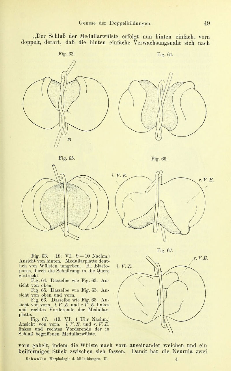 „Der Schluß der Medullarwülste erfolgt nun hinten einfach, vorn doppelt, derart, daß die hinten einfache Verwaehsungsnaht sich nach Fig-. 63. Fig. 64. r. F. E. r. V.E. l. V. E. Fig. 67. Fig. 63. (18. VI. 9 — 10 Nachm.) Ansicht von hinten. Medullarplatte deut- lich von Wülsten umgeben. Bl. Blasto- porus, durch die Schnürung in die Quere gestreckt. Fig. 64. Dasselbe wie Fig. 63. An- sicht von oben. Fig. 65. Dasselbe wie Fig. 63. An- sicht von oben und vorn. Fig. 66. Dasselbe wie Fig. 63. An- sicht von vorn. l. V. E. und r. V. E. linkes und rechtes Vorderende der Medullar- platte. Fig. 67. (19. VI. 1 Uhr Nachm.) Ansicht von vorn. /. V.E. und r. V.E. linkes und rechtes Vorderende der in Schluß begriffenen Medullarwülste. vorn gabelt, indem die Wülste nach vorn auseinander weichen und ein keilförmiges Stück zwischen sich fassen. Damit hat die Neurula zwei Sdiwallje, Morphologie d. Mißbildungen. II. 4