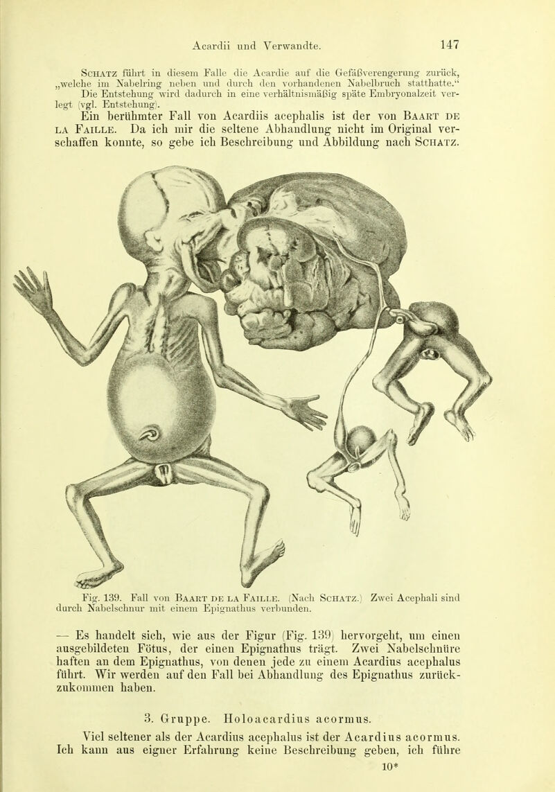 Schatz führt in diesem Falle die Acardie auf die Gefäßverengeriuig zurück, „welche im Xaljelriug neben und durch den vorhandenen Nabelbruch statthatte. Die Entstehung wird dadui'ch in eine verhältnismäßig späte Embryonalzeit ver- legt (vgl. Entstehung'. Ein berühmter Fall von Acardiis acephalis ist der von Baart de LA Faille. Da ich mir die seltene Abhandlung nicht im Original ver- schaffen konnte, so gebe ich Beschreibung und Abbildung nach Schatz. Fig. 139. Fall von Baart de la Faille. (Nach Schatz.; Zwei Acephali sind durch Nabelschnur mit einem Epignathus verbunden. •— Es handelt sich, wie aus der Figur (Fig. 139) hervorgeht, um einen ausgebildeten Fötus, der einen Epignathus trägt. Zwei Nabelschnüre haften an dem Epignathus, von denen jede zu einem Acardius acephalus führt. Wir werden auf den Fall bei Abhandlung des Epignathus zurück- zukommen haben. 3. Gruppe. Holoacardius acormus. Viel seltener als der Acardius acephalus ist der Acardius acormus. Ich kann aus eigner Erfahrung keine Beschreibung geben, ich führe 10*
