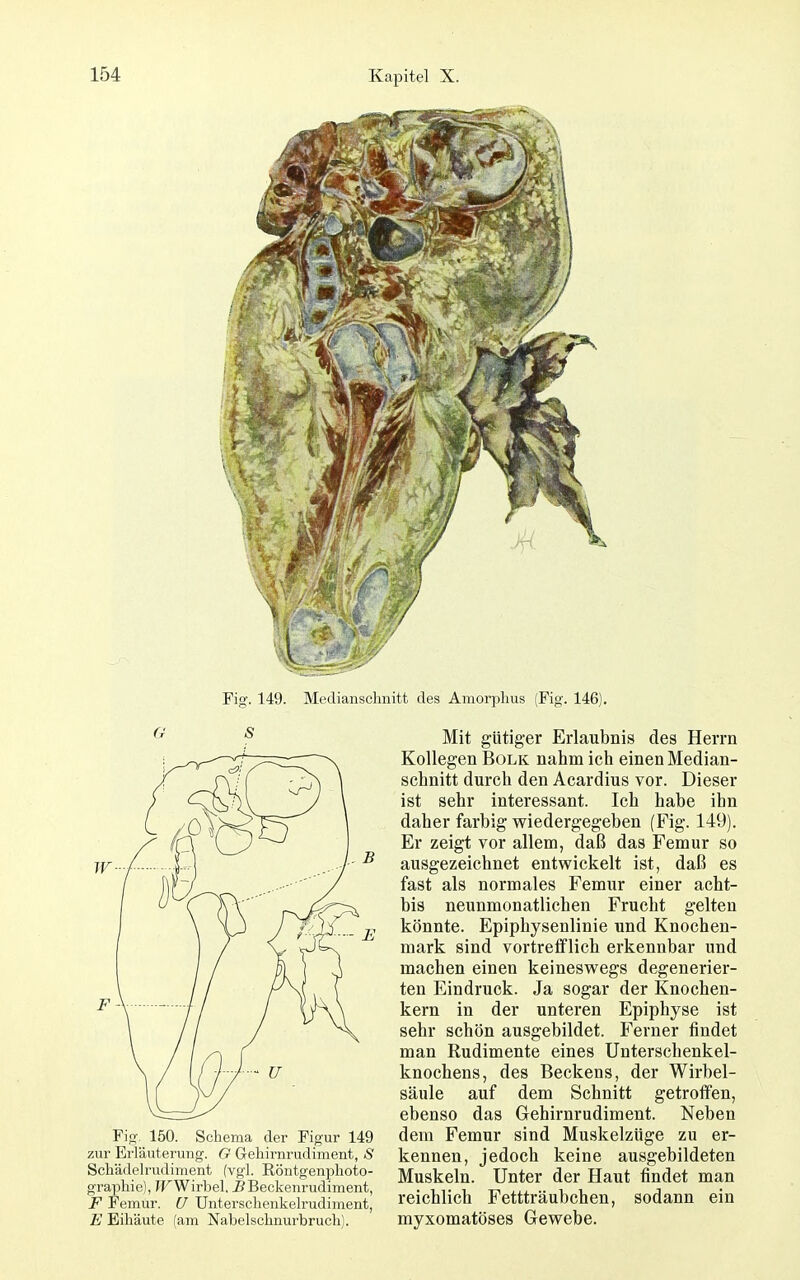 Fig. 149. Mediansclmitt des Amorplius (Fig. 146). G S Fig 150. Schema der Figur 149 zur Erläuterung. G Geliirnrudiment, S Schädelrudiment (vgl. Röntgenphoto- graphie), ^FWirbel, ^Beckenrudiment, F Femur. U Unterschenkelrudiment, i' Eihäute (am Nabelschnurbruch). Mit gütiger Erlaubnis des Herrn Kollegen Bolk nahm ich einen Median- schnitt durch den Acardius vor. Dieser ist sehr interessant. Ich habe ihn daher farbig wiedergegeben (Fig. 149). Er zeigt vor allem, daß das Femur so ausgezeichnet entwickelt ist, daß es fast als normales Femur einer acht- bis neunmonatlichen Frucht gelten könnte. Epiphysenlinie und Knochen- mark sind vortrefflich erkennbar und machen einen keineswegs degenerier- ten Eindruck. Ja sogar der Knochen- kern in der unteren Epiphyse ist sehr schön ausgebildet. Ferner findet man Rudimente eines Unterschenkel- knochens, des Beckens, der Wirbel- säule auf dem Schnitt getroffen, ebenso das Gehirnrudiment. Neben dem Femur sind Muskelzüge zu er- kennen, jedoch keine ausgebildeten Muskeln. Unter der Haut findet man reichlich Fettträubchen, sodann myxomatöses Gewebe. ein