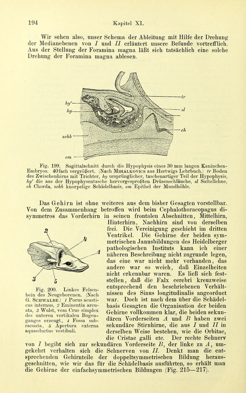 Wir sehen also, unser Schema der Ableitung mit Hilfe der Drehung der Medianebenen von / und II erläutert unsere Befunde vortrefflich. Aus der Stellung der Foramina magna läßt sich tatsächlich eine solche Drehung der Foramina magna ablesen. Fig. 199. Sagittalschnitt durch die Hypophysis eines 30 mm langen Kaninchen- Embryos. 40 fach vergrößert. (Nach Mihalkovics aus Hartwigs Lehrbuch.) tr Boden des Zwischenhims mit Trichter, /*// ursprünglicher, taschenartiger Teil der Hypophysis, hy' die aus der Hypophysentasche hervorgesproßten Drüsenschläuche, sl Sattellehne, ch Chorda, schh knorpelige Schädelbasis, em Epithel der Mundhöhle. Das Gehirn ist ohne weiteres aus dem bisher Gesagten vorstellbar. Von dem Zusammenhang betroffen wird beim Cephalothoracopagus di- symmetros das Vorderhirn in seinen frontalen Abschnitten, Mittelhirn, Hinterhirn, Nachhirn sind von derselben frei. Die Vereinigung geschieht im dritten Ventrikel. Die Gehirne der beiden sym- metrischen Janusbildungen des Heidelberger pathologischen Instituts kann ich einer näheren Beschreibung nicht zugrunde legen, das eine war nicht mehr vorhanden, das andere war so weich, daß Einzelheiten nicht erkennbar waren. Es ließ sich fest- stellen, daß die Falx cerebri kreuzweise entsprechend den beschriebenen Verhält- nissen des Sinus longitudinalis angeordnet war. Doch ist nach dem über die Schädel- basis Gesagten die Organisation der beiden Gehirne vollkommen klar, die beiden sekun- dären Vorderseiten A und B haben zwei sekundäre Stirnhirne, die aus I und II in derselben Weise bestehen, wie die Orbitae, die Cristae galli etc. Der rechte Sehnerv von I begibt sich zur sekundären Vorderseite B, der linke zu um- gekehrt verhalten sich die Sehnerven von II. Denkt man die ent- sprechenden Gehirnteile der doppeltsymmetrischen Bildung heraus- geschnitten, wie wir das für die Schädelbasis ausführten, so erhält man die Gehirne der einfachsymmetrischen Bildungen (Fig. 215—217). 2 Fig. 200. Linkes Felsen- bein des Neugeborenen. (Nach Gr. Schwalbe.) l Porus acusti- cus internus, 2 Eminentia arcu- ata, 3 Wulst, vom Crus simplex des unteren vertikalen Bogen- ganges erzeugt, i Fossa sub- racuata, 5 Apertura externa aquaeductus vestibuli.