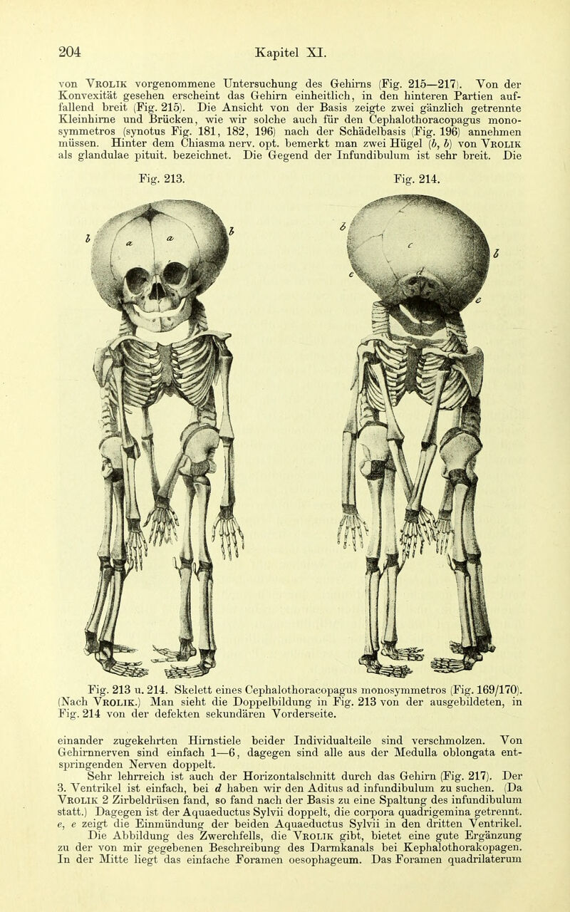 von Vrolik vorgenommene Untersuchung des Gehirns (Fig. 215—217). Von der Konvexität gesehen erscheint das Gehirn einheitlich, in den hinteren Partien auf- fallend breit (Fig. 215). Die Ansicht von der Basis zeigte zwei gänzlich getrennte Kleinhirne und Brücken, wie wir solche auch für den Cephalothoracopagus mono- symmetros (synotus Fig. 181, 182, 196) nach der Schädelbasis (Fig. 196) annehmen müssen. Hinter dem Chiasma nerv. opt. bemerkt man zwei Hügel [b, b) von Vkolik als glandulae pituit. bezeichnet. Die Gegend der Infundibulum ist sehr breit. Die Fig. 213. Fig. 214. Fig. 213 u. 214. Skelett eines Cephalothoracopagus monosymmetros (Fig. 169/170). (Nach Vrolik.) Man sieht die Doppelbildung in Fig. 213 von der ausgebildeten, in Fig. 214 von der defekten sekundären Vorderseite. einander zugekehrten Hirnstiele beider Individualteile sind verschmolzen. Von Gehirnnerven sind einfach 1—6, dagegen sind alle aus der Medulla oblongata ent- springenden Nerven doppelt. Sehr lehrreich ist auch der Horizontalschnitt durch das Gehirn (Fig. 217). Der 3. Ventrikel ist einfach, bei d haben wir den Aditus ad infundibulum zu suchen. (Da Vrolik 2 Zirbeldrüsen fand, so fand nach der Basis zu eine Spaltung des infundibulum statt.) Dagegen ist der Aquaeductus Sylvii doppelt, die corpora quadrigemina getrennt, c, e zeigt die Einmündung der beiden Aquaeductus Sylvii in den dritten Ventrikel. Die Abbildung des Zwerchfells, die Veolik gibt, bietet eine gute Ergänzung zu der von mir gegebenen Beschreibung des Darmkanals bei Kephalothorakopagen. In der Mitte liegt das einfache Foramen oesophageum. Das Foramen quadrilaterum