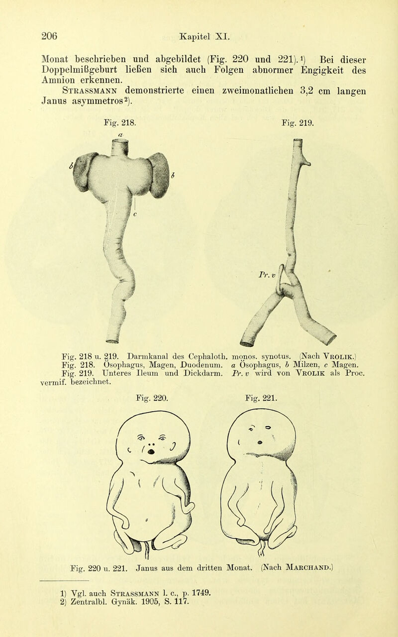 Monat beschrieben und abgebildet (Fig. 220 und 221). i) Bei dieser Doppelmißgeburt ließen sich auch Folgen abnormer Engigkeit des Amnion erkennen. Strassmann demonstrierte einen zweimonatlichen 3,2 cm langen Janus asymmetros^). Fig. 218. Fig. 219. Fig. 218 u. 219. Darmkanal des Cephalotli. monos. synotus. (Nach Vrolik.) Fig. 218. Ösophagus, Magen, Duodenum, a Ösophagus, h Milzen, c Magen. Fig. 219. Unteres Ileum und Dickdarm. Tr. v wird von VrOLIK als Proc. vermif. bezeichnet. Fig. 220. Fig. 221. Fig. 220 u. 221. Janus aus dem dritten Monat. (Nach Marchand.) 1) Vgl. auch Strassmann 1. c, p. 1749. 2) Zentralbl. Gynäk. 1905, S. 117. <