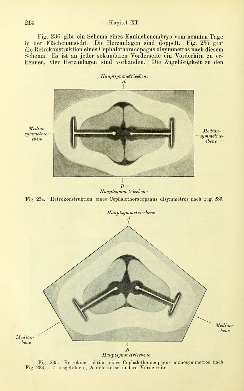 Fig. 236 gibt ein Schema eines Kaninchenembryo vom neunten Tage in der Flächenansicht. Die Herzanlagen sind doppelt. Fig. 237 gibt die Retrokonstruktion eines Cephalothoracopagus disymmetros nach diesem Schema. Es ist an jeder sekundären Vorderseite ein Vorderhirn zu er- kennen, vier Herzanlagen sind vorhanden. Die Zugehörigkeit zu den Hauptsymmetrieehene A Median- symmetrie-' ebene Median- symmetrie- ebene Hauptsymmetrieebene Fig. 234. ßetrokonstruktion eines Cephalothoracopagus disymmetros nach Fig. 233. Hauptsymmetrieehene A Siedian- ebene Median- ebene Fig. Fig. 233. Hauptsymmetrieebene Retrokonstruktion eines Cephalothoracopagus monosymmetros nach 235. A ausgebildete £ defekte sekundäre Vorderseite.