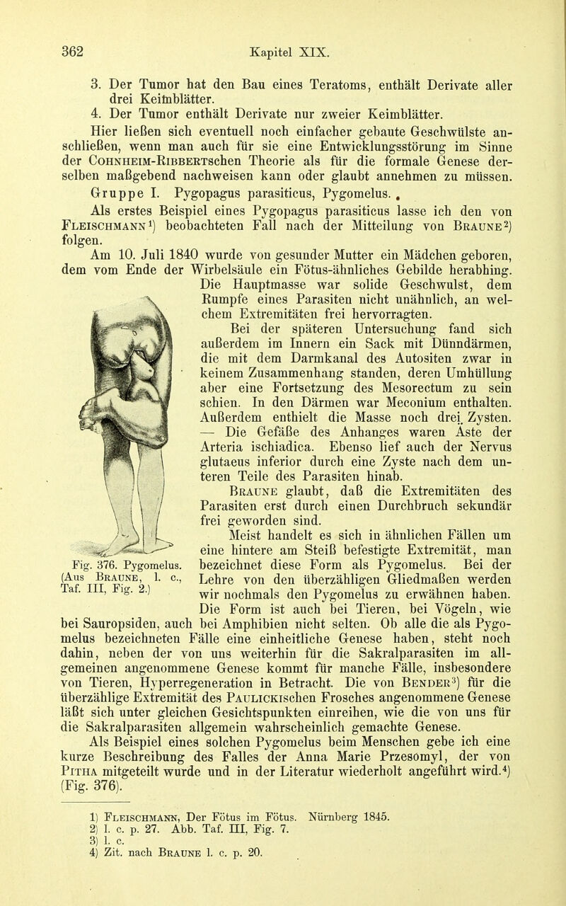 3. Der Tumor hat den Bau eines Teratoms, enthält Derivate aller drei Keitnblätter. 4. Der Tumor enthält Derivate nur zweier Keimblätter. Hier ließen sich eventuell noch einfacher gebaute Geschwülste an- schließen, wenn man auch für sie eine Entwicklungsstörung im Sinne der CoHNHEiM-RiBBERTschen Theorie als für die formale Genese der- selben maßgebend nachweisen kann oder glaubt annehmen zu müssen. Gruppe I. Pygopagus parasiticus, Pygomelus. , Als erstes Beispiel eines Pygopagus parasiticus lasse ich den von Fleischmann 1) beobachteten Fall nach der Mitteilung von Braune 2) folgen. Am 10. Juli 1840 wurde von gesunder Mutter ein Mädchen geboren, dem vom Ende der Wirbelsäule ein Fötus-ähnliches Gebilde herabhing. Die Hauptmasse war solide Geschwulst, dem Rumpfe eines Parasiten nicht unähnlich, an wel- chem Extremitäten frei hervorragten. Bei der späteren Untersuchung fand sich außerdem im Innern ein Sack mit Dünndärmen, die mit dem Darmkanal des Autositen zwar in keinem Zusammenhang standen, deren Umhüllung aber eine Fortsetzung des Mesorectum zu sein schien. In den Därmen war Meconium enthalten. Außerdem enthielt die Masse noch drei. Zysten. — Die Gefäße des Anhanges waren Aste der Arteria ischiadica. Ebenso lief auch der Nervus glutaeus inferior durch eine Zyste nach dem un- teren Teile des Parasiten hinab. Braune glaubt, daß die Extremitäten des Parasiten erst durch einen Durchbruch sekundär frei geworden sind. Meist handelt es sich in ähnlichen Fällen um eine hintere am Steiß befestigte Extremität, man bezeichnet diese Form als Pygomelus. Bei der Lehre von den überzähligen Gliedmaßen werden wir nochmals den Pygomelus zu erwähnen haben. Die Form ist auch bei Tieren, bei Vögeln, wie bei Sauropsiden, auch bei Amphibien nicht selten. Ob alle die als Pygo- melus bezeichneten Fälle eine einheitliche Genese haben, steht noch dahin, neben der von uns weiterhin für die Sakralparasiten im all- gemeinen angenommene Genese kommt für manche Fälle, insbesondere von Tieren, Hyperregeneration in Betracht. Die von Benderfür die überzählige Extremität des PAULiCKischen Frosches angenommene Genese läßt sich unter gleichen Gesichtspunkten einreihen, wie die von uns für die Sakralparasiten allgemein wahrscheinlich gemachte Genese. Als Beispiel eines solchen Pygomelus beim Menschen gebe ich eine kurze Beschreibung des Falles der Anna Marie Przesomyl, der von PiTHA mitgeteilt wurde und in der Literatur wiederholt angeführt wird.*) (Fig. 376). Fig. 376. Pygomelus (Aus Braune, 1. c. Taf. III, Piff. 2.) 1) Fleischmann, Der Fötus im Fötus. Nürnberg 1845. 2) 1. c. p. 27. Abb. Taf. HI, Fig. 7. 3) 1. c. 4) Zit. nach Braune 1. c. p. 20.