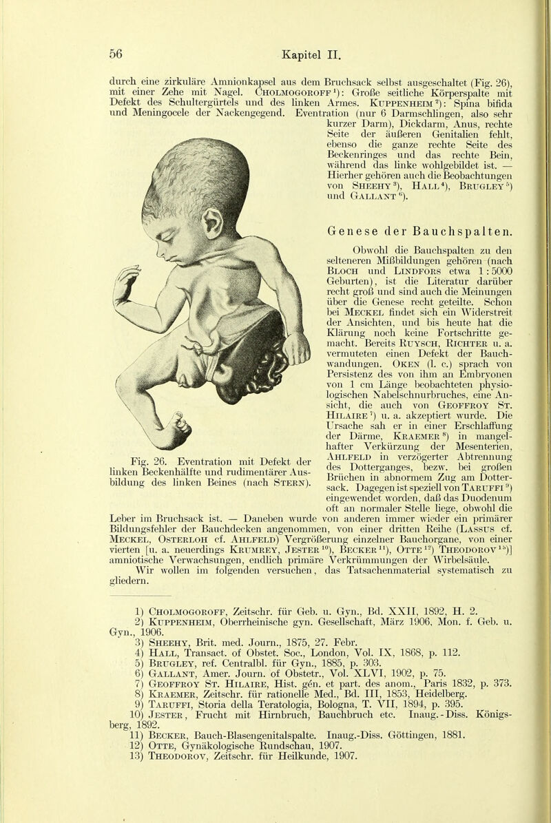 durch eine zirkuläre Amuionkapsel aus dem Bruchsack selbst ausgeschaltet (Fig. 26), mit einer Zehe mit Nagel. Cholmogorofp'): Große seitliche Körperspalte mit Defekt des Schultergürtels und des und Meningocele der Nackengegend. linken Armes. Kuppenheim ^): Spina bifida Eventration (nur 6 Darmschlingen, also sehr kurzer Darm), Dickdarm, Anus, rechte Seite der äußeren GenitaHen fehlt, ebenso die ganze rechte Seite des Beckenringes und das rechte Bein, während das linke wohlgebildet ist. — Hierher gehören auch die Beobachtungen von Sheehy'), Hall^), Brugley) und Gallant Genese der Bauchspalten. Obwohl die Bauchspalten zu den selteneren Mißbildungen gehören (nach Bloch und Lindfors etwa 1:5000 Geburten), ist die Literatur darüber recht groß und sind auch die Meinungen über die Genese recht geteilte. Schon bei Meckel findet sich ein Widerstreit der Ansichten, und bis heute hat die Klärung noch keine Fortschritte ge- macht. Bereits Ruysch, Richter u. a. vermuteten einen Defekt der Bauch- wandungen. Oken (1. c.) sprach von Persistenz des von ihm an Embryonen von 1 cm Länge beobachteten physio- logischen Nabelschnurbruches, eme An- sicht, die auch von Geoffroy St. HiLAiRE') u. a. akzeptiert wurde. Die Ursache sah er in einer Erschlaffung der Därme, Kraemer ^) in mangel- hafter Verkürzung der Mesenterien, j^Vhlfeld in verzögerter Abtrennung des Dotterganges, bezw. bei großen Brüchen in abnormem Zug am Dotter- sack. Dagegen ist speziell von Taruffi ) eingewendet worden, daß das Duodenum oft an normaler Stelle hege, obwohl die Leber im Bruchsack ist. — Daneben wurde von anderen immer wieder ein jDrimärer Bildungsfelller der Bauchdecken angenommen, von einer dritten Reihe (Lassus cf. Meckel, Osterloh cf. Ahi^feld) Vergrößerung einzelner Bauchorgane, von einer vierten [u. a. neuerdings Krumrey, Jester'), Becker''), Otte'-) Theodorov'^)] amniotische Verwachsungen, endhch primäre Verkrümmungen der Wirbelsäule. Wir woUen im folgenden versuchen, das Tatsachenmaterial systematisch zu gliedern. Fig. 26. Eventration mit Defekt der lüiken Beckenhälfte und rudimentärer Aus- bildung des linken Beines (nach Stern). 1) Cholmogoroff, Zeitschr. für Geb. u. Gyn., Bd. XXII, 1892, H. 2. 2) Kuppenheim, Oberrheinische gyn. Gesellschaft, März 1906, Mon. f. Geb. u. Gyn., 1906. 3) Sheehy, Brit. med. Journ., 1875, 27. Febr. 4) Hall, Transact. of Obstet. Soc, London, Vol. IX, 1868, p. 112. 5) Brugley, ref. Centralbl. für Gyn., 1885, p. 303. 6) Gallant, Amer. Journ. of Obstetr., Vol. XLVI, 1902, p. 75. 7) Geoffroy St. Hilaire, Hist. gön. et part. des anom., Paris 1832, p. 373. 8) Kraemer, Zeitschr. für rationelle Med., Bd. III, 1853, Heidelberg. 9) Taruffi, Storia della Teratologia, Bologna, T. VII, 1894, p. 395. 10) Jester, Frucht mit Hirnbruch, Bauchbmch etc. Inaug.-Diss. Königs- berg, 1892. 11) Becker, Bauch-Blasengenitalspalte. Inaug.-Diss. Göttingen, 1881. 12) Otte, Gynäkologische Rundschau, 1907. 13) Theodorov, Zeitschr. für Heilkunde, 1907.