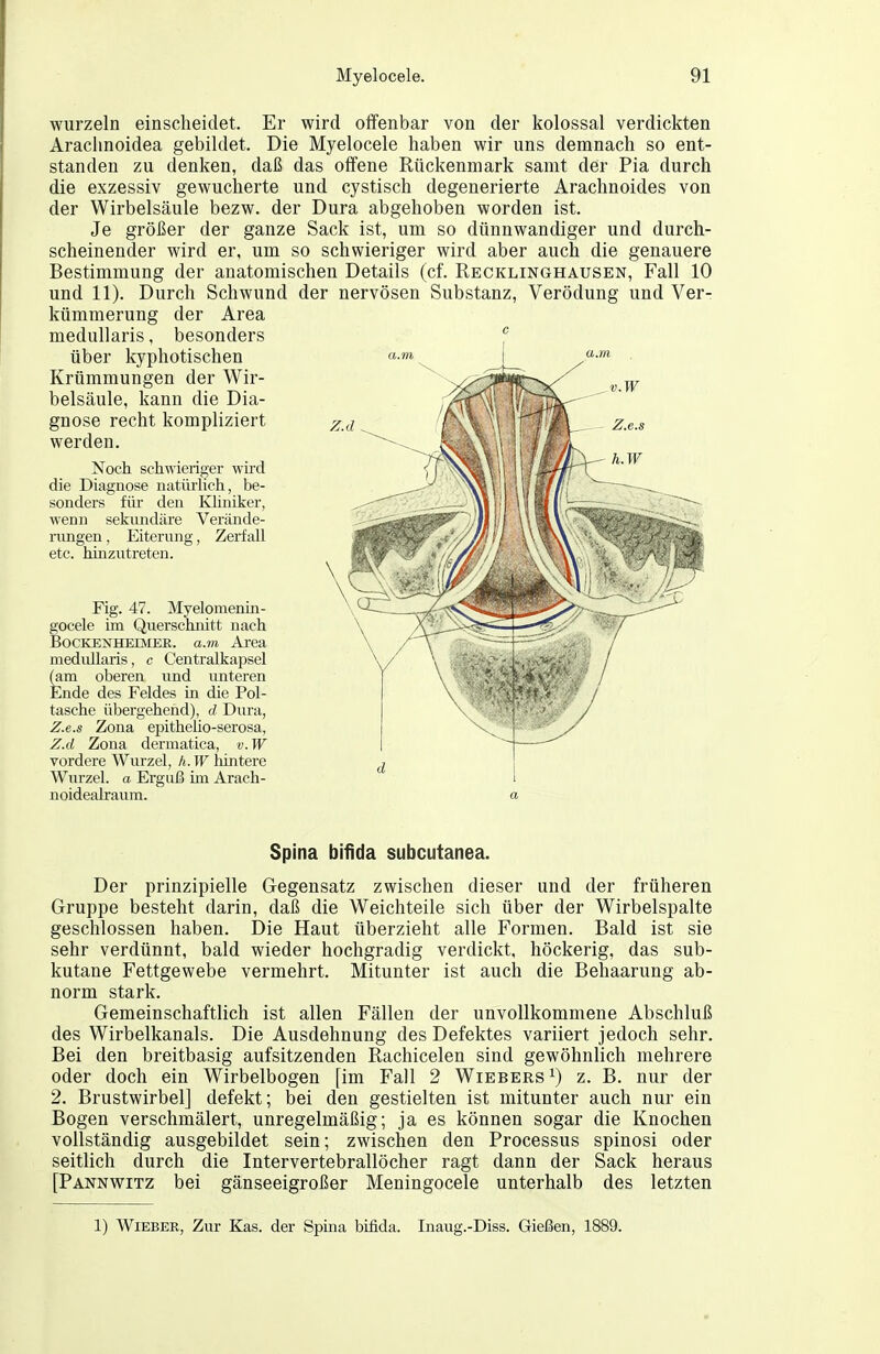 wurzeln ein scheidet. Er wird offenbar von der kolossal verdickten Araclmoidea gebildet. Die Myelocele haben wir uns demnach so ent- standen zu denken, daß das offene Rückenmark samt der Pia durch die exzessiv gewucherte und cystisch degenerierte Arachnoides von der Wirbelsäule bezw. der Dura abgehoben worden ist. Je größer der ganze Sack ist, um so dünnwandiger und durch- scheinender wird er, um so schwieriger wird aber auch die genauere Bestimmung der anatomischen Details (cf. Recklinghausen, Fall 10 und 11). Durch Schwund der nervösen Substanz, Verödung und Ver- kümmerung der Area medullaris, besonders über kyphotischen Krümmungen der Wir- belsäule, kann die Dia- gnose recht kompliziert werden. Noch schwieriger wird die Diagnose natüiiich, be- sonders für den Kliniker, wenn sekundäre Verände- rungen , Eiterung, Zerfall etc. hinzutreten. Fig. 47. Myelomenm- gocele im Querschnitt nach BocKENHEEViEE. a.m Area medullaris, c Centralkapsel (am oberen und unteren Ende des Feldes in die Pol- tasche übergehend), d Dura, Z.e.s Zona epithelio-serosa, Z.d Zona dermatica, v.W vordere Wurzel, h. W hintere Wurzel, a Erguß im Arach- noidealraum. a Spina bifida subcutanea. Der prinzipielle Gegensatz zwischen dieser und der früheren Gruppe besteht darin, daß die Weichteile sich über der Wirbelspalte geschlossen haben. Die Haut überzieht alle Formen. Bald ist sie sehr verdünnt, bald wieder hochgradig verdickt, höckerig, das sub- kutane Fettgewebe vermehrt. Mitunter ist auch die Behaarung ab- norm stark. Gemeinschaftlich ist allen Fällen der unvollkommene Abschluß des Wirbelkanals. Die Ausdehnung des Defektes variiert jedoch sehr. Bei den breitbasig aufsitzenden Rachicelen sind gewöhnlich mehrere oder doch ein Wirbelbogen [im Fall 2 Wiebers ^) z. B. nur der 2. Brustwirbel] defekt; bei den gestielten ist mitunter auch nur ein Bogen verschmälert, unregelmäßig; ja es können sogar die Knochen vollständig ausgebildet sein; zwischen den Processus spinosi oder seitlich durch die Intervertebrallöcher ragt dann der Sack heraus [Pannwitz bei gänseeigroßer Meningocele unterhalb des letzten 1) WiEBER, Zur Kas. der Spina bifida. Inaug.-Diss. Gießen, 1889.