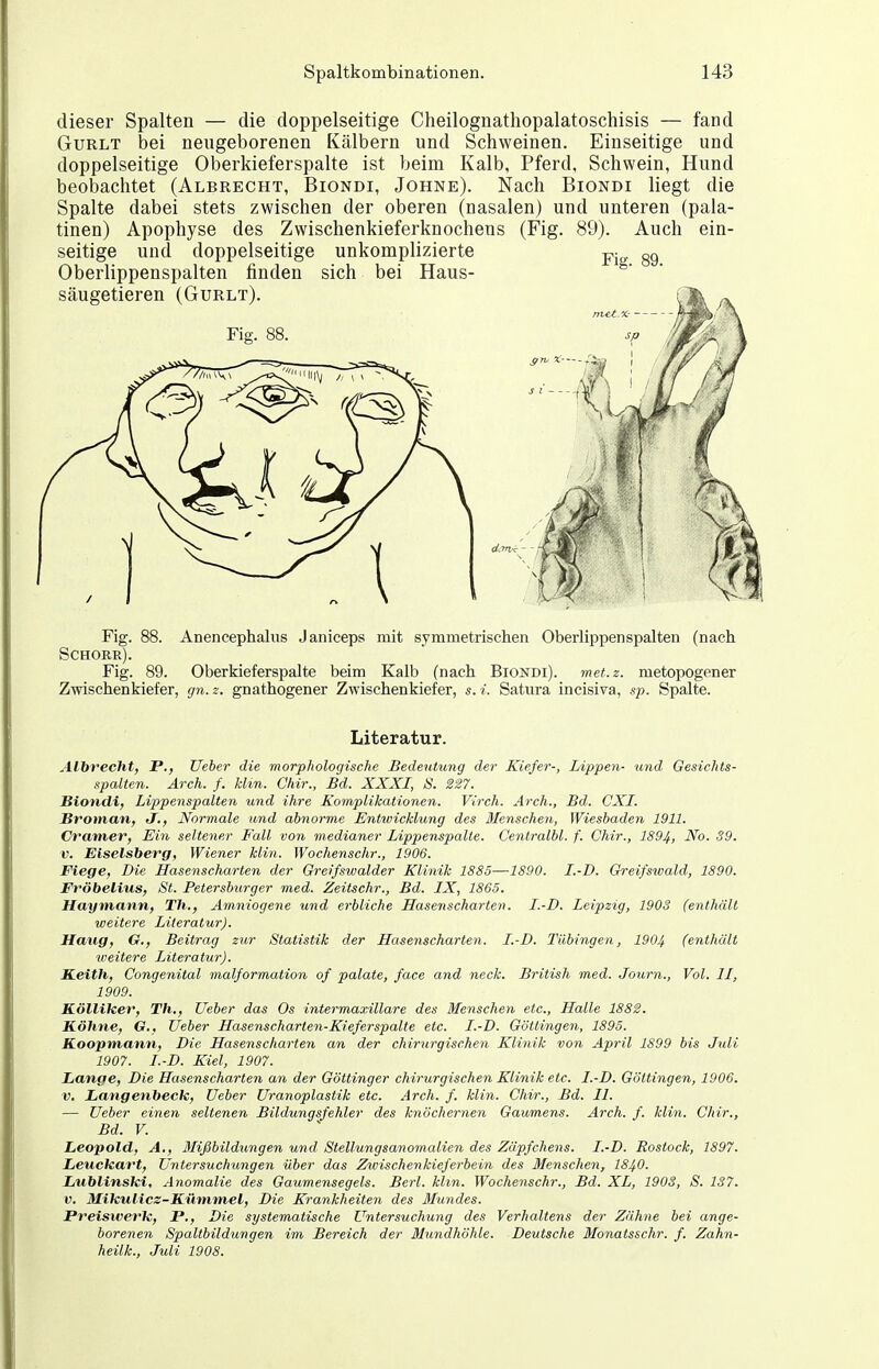 dieser Spalten — die doppelseitige Cheilognathopalatoschisis — fand GuRLT bei neugeborenen Kälbern und Schweinen. Einseitige und doppelseitige Oberkieferspalte ist beim Kalb, Pferd, Schwein, Hund beobachtet (Albrecht, Biondi, Johne). Nach Biondi liegt die Spalte dabei stets zwischen der oberen (nasalen) und unteren (pala- tinen) Apophyse des Zwischenkieferknochens (Fig. 89). Auch ein- seitige und doppelseitige unkomplizierte gg Oberlippenspalten finden sich bei Haus- Fig. 88. Anencephalus Janiceps mit symmetrischen Oberlippen spalten (nach Schorr). Fig. 89. Oberkieferspalte beim Kalb (nach Biondi). met.z. metopogener Zwischenkiefer, gn.z. gnathogener Zwischenkiefer, s.i. Satura incisiva, sp. Spalte. Literatur. Albrecht, F., lieber die morphologische Bedeutung der Kiefer-, Lippen- und Gesichts- spalten. Arch. f. Hin. Chir., Bd. XXXI, S. 227. Biondi, Lippenspalten und ihre Komplikationen. Virch. Arch., Bd. CXI. Broman, J,, Normale und abnorme Entwicklung des Menschen, Wiesbaden 1911. Cramer, Ein seltener Fall von medianer Lippenspalte. Centralbl. f. Chir., 1894, ^o. 39. V. Eiseisberg, Wiener klin. Wochenschr., 1906. Wiege, Die Hasenscharten der Greifswalder Klinik 1885—1890. I.-D. Greifswald, 1890. Fröbelius, St. Petersburger med. Zeitschr., Bd. IX, 1865. Haymann, Th., Amniogene und erbliche Hasenscharten. I.-D. Leipzig, 1903 (enthält weitere Literatur). Hang, G., Beitrag zur Statistik der Hasenscharten. I.-D. Tübingen, 1904 (enthält loeitere Literatur). K.eith, Congenital malformation of palate, face and neck. British med. Journ., Vol. II, 1909. Kölliher, Th., Ueber das Os intermaxillare des Menschen etc., Halle 1882. Köhne, G., Ueber Hasenscharten-Kieferspalte etc. I.-D. Göttingen, 1895. Koopmann, Die Hasenscharten an der chirurgischen Klinik von April 1899 bis Juli 1907. I.-D. Kiel, 1907. Lange, Die Hasenscharten an der Göttinger chirurgischen Klinik etc. I.-D. Göttingen, 1906. V. Langenbeck, Ueber Uranoplastik etc. Arch. f. klin. Chir., Bd. II. — Ueber einen seltenen Bildungsfehler des knöchernen Gaumens. Arch. f. klin. Chir., Bd. V. Leopold, A., Blißbildungen und Stellungsanomalien des Zäpfchens. I.-D. Rostock, 1897. Leuckart, Untersuchungen über das Zwischenkieferbein des Menschen, I84O. Lublinski, Anomalie des Gaumensegels. Berl. klin. Wochenschr., Bd. XL, 1903, S. 137. V. Mikulics-Kümmel, Die Krankheiten des ßlundes. Preiswerk, JP,, Die systematische Untersuchung des Verhaltens der Zähne bei ange- borenen Spaltbildungen im Bereich der Mundhöhle. Deutsche Monatsschr. f. Zahn- heilk., Juli 1908.
