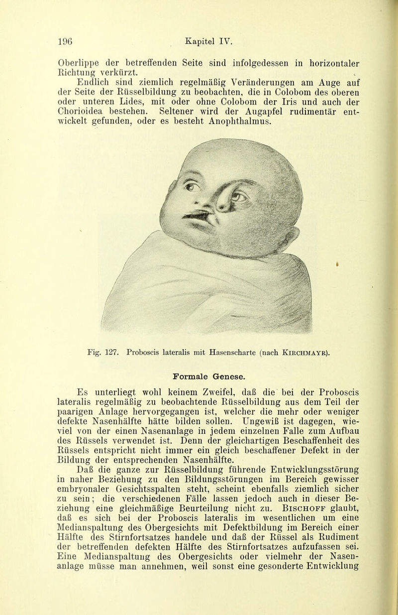 Oberlippe der betreffenden Seite sind infolgedessen in horizontaler Richtung verkürzt. Endlich sind ziemlich regelmäßig Veränderungen am Auge auf der Seite der Rüsselbildung zu beobachten, die in Colobom des oberen oder unteren Lides, mit oder ohne Colobom der Iris und auch der Chorioidea bestehen. Seltener wird der Augapfel rudimentär ent- wickelt gefunden, oder es besteht Anophthalmus. Fig. 127. Proboscis lateralis mit Hasenscharte (nach Kiechmayr). Formale Genese. Es unterliegt wohl keinem Zweifel, daß die bei der Proboscis lateralis regelmäßig zu beobachtende Rüsselbildung aus dem Teil der paarigen Anlage hervorgegangen ist, welcher die mehr oder weniger defekte Nasenhälfte hätte bilden sollen. Ungewiß ist dagegen, wie- viel von der einen Nasenanlage in jedem einzelnen Falle zum Aufbau des Rüssels verwendet ist. Denn der gleichartigen Beschaffenheit des Rüssels entspricht nicht immer ein gleich beschaffener Defekt in der Bildung der entsprechenden Nasenhälfte. Daß die ganze zur Rüsselbildung führende Entwicklungsstörung in naher Beziehung zu den Bildungsstörungen im Bereich gewisser embryonaler Gesichtsspalten steht, scheint ebenfalls ziemlich sicher zu sein; die verschiedenen Fälle lassen jedoch auch in dieser Be- ziehung eine gleichmäßige Beurteilung nicht zu. Bischoff glaubt, daß es sich bei der Proboscis lateralis im wesentlichen um eine Medianspaltung des Obergesichts mit Defektbildung im Bereich einer Hälfte des Stirnfortsatzes handele und daß der Rüssel als Rudiment der betreffenden defekten Hälfte des Stirnfortsatzes aufzufassen sei. Eine Medianspaltuug des Obergesichts oder vielmehr der Nasen- anlage müsse man annehmen, weil sonst eine gesonderte Entwicklung
