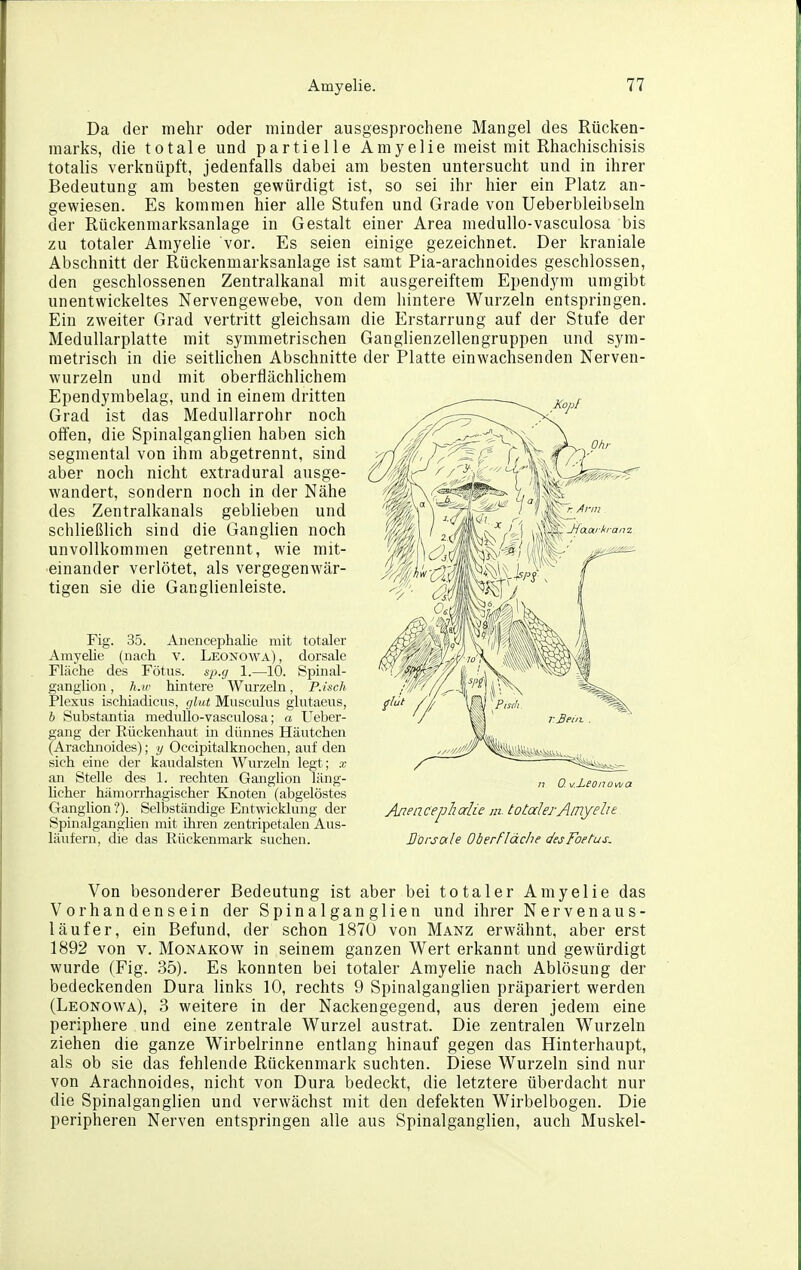 Da der mehr oder minder ausgesprochene Mangel des Rücken- marks, die totale und partielle Amyelie meist mit Rhachischisis totalis verknüpft, jedenfalls dabei am besten untersucht und in ihrer Bedeutung am iDesten gewürdigt ist, so sei ihr hier ein Platz an- gewiesen. Es kommen hier alle Stufen und Grade von Ueberbleibseln der Rückenmarksanlage in Gestalt einer Area medullo-vasculosa bis zu totaler Amyelie vor. Es seien einige gezeichnet. Der kraniale Abschnitt der Rückenmarksanlage ist samt Pia-arachnoides geschlossen, den geschlossenen Zentralkanal mit ausgereiftem Ependym umgibt unentwickeltes Nervengewebe, von dem hintere Wurzeln entspringen. Ein zweiter Grad vertritt gleichsam die Erstarrung auf der Stufe der Medullarplatte mit symmetrischen Ganglienzellengruppen und sym- metrisch in die seitlichen Abschnitte der Platte einwachsenden Nerven- wurzeln und mit obertlächlichera Ependymbelag, und in einem dritten Grad ist das Medullarrohr noch offen, die Spinalganglien haben sich segmental von ihm abgetrennt, sind aber noch nicht extradural ausge- wandert, sondern noch in der Nähe des Zentralkanals geblieben und schließlich sind die Ganglien noch unvollkommen getrennt, wie mit- einander verlötet, als vergegenwär- tigen sie die Ganglienleiste. Fig. 35. Anencephalie mit totaler Amyelie (nach v. Leonowa), dorsale Fläche des Fötus, sjy.g 1.—10. Spinal- gangüon, h.iv hintere Wurzeln, P.isch Plexus ischiadicus, (ßut Muscuhis glutaeus, b Substantia medullo-vasculosa; a Ueber- gang der Eückenhaut in dünnes Häutchen (Arachnoides); y Occipitalknochen, auf den sich eine der kaudalsten Wurzehi legt; x an Stelle des 1. rechten Ganghon läng- licher hämorrhagischer Knoten (abgelöstes Ganglion ?). Selbständige Entwickhuig der Spmalganghen mit ihren zentripetalen Aus- läufern, die das Rückenmark suchen. Von besonderer Bedeutung ist aber bei totaler Amyelie das Vorhandensein der Spina Igan glien und ihrer Nerven aus- läufer, ein Befund, der schon 1870 von Manz erwähnt, aber erst 1892 von V. Monakow in seinem ganzen Wert erkannt und gewürdigt wurde (Fig. 35). Es konnten bei totaler Amyelie nach Ablösung der bedeckenden Dura links 10, rechts 9 Spinalganglien präpariert werden (Leonowa), 3 weitere in der Nackengegend, aus deren jedem eine periphere und eine zentrale Wurzel austrat. Die zentralen Wurzeln ziehen die ganze W^irbelrinne entlang hinauf gegen das Hinterhaupt, als ob sie das fehlende Rückenmark suchten. Diese Wurzeln sind nur von Arachnoides, nicht von Dura bedeckt, die letztere überdacht nur die Spinalganglien und verwächst mit den defekten Wirbelbogen. Die peripheren Nerven entspringen alle aus Spinalganglien, auch Muskel-