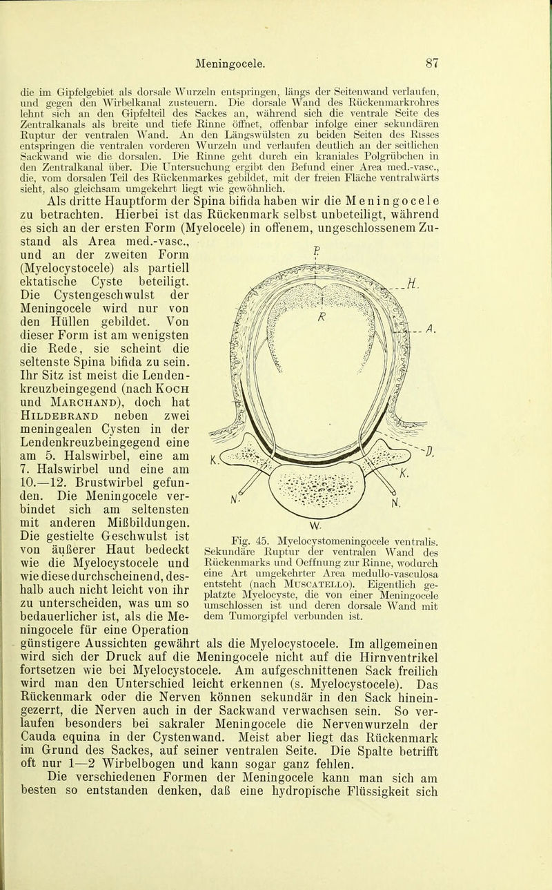 die im Gipfelgebiet als dorsale AVurzeln entspringen, längs der Seitenwand verlaixfen, und gegen den Wirbelkanal zusteuern. Die dorsale Wand des Rückenmarkrohres lehnt sich an den Gipfelteil des Sackes an, wähi-end sich die ventrale Seite des Zentralkanals als breite und tiefe Emne öifnet, oifenbar infolge einer sekundären Ruptur der ventralen Wand. An den Längswülsten zu beiden Seiten des Risses entspringen die ventralen vorderen Wurzeln und verlaufen deutlich an der seitlichen Sackwand wie die dorsalen. Die Rinne geht durch ein kraniales Polgrübchen in den Zentralkanal über. Die Untersuchung ergibt den Befund einer Area med.-vasc, die, vom dorsalen Teil des Rückenmarkes gebildet, mit der freien Fläche ventralwärts sieht, also gleichsam umgekehrt liegt wie gewöhnlich. Als dritte Hauptform der Spina bifida haben wir die M e n i n g o c e I e zu betrachten. Hierbei ist das Rückenmark selbst unbeteiligt, während es sich an der ersten Form (Myelocele) in offenem, ungeschlossenem Zu- stand als Area med.-vasc, und an der zweiten Form ? (Myelocystocele) als partiell ektatische Cyste beteiligt. Die Cystengeschwulst der Meningocele wird nur von den Hüllen gebildet. Von dieser Form ist am wenigsten die Rede, sie scheint die seltenste Spina bifida zu sein. Ihr Sitz ist meist die Lenden- kreuzbeingegend (nach Koch und Marchand), doch hat Hildebrand neben zwei meningealen Cysten in der Lendenkreuzbeingegend eine am 5. Halswirbel, eine am 7. Halswirbel und eine am 10.—12. Brustwirbel gefun- den. Die Meningocele ver- bindet sich am seltensten mit anderen Mißbildungen. Die gestielte Geschwulst ist von äußerer Haut bedeckt wie die Myelocystocele und wie diese durchscheinend, des- halb auch nicht leicht von ihr zu unterscheiden, was um so bedauerlicher ist, als die Me- ningocele für eine Operation günstigere Aussichten gewährt als die Myelocystocele, Im allgemeinen wird sich der Druck auf die Meningocele nicht auf die Hirnventrikel fortsetzen wie bei Myelocystocele. Am aufgeschnittenen Sack freilich wird man den Unterschied leicht erkennen (s. Myelocystocele). Das Rückenmark oder die Nerven können sekundär in den Sack hinein- gezerrt, die Nerven auch in der Sackwand verwachsen sein. So ver- laufen besonders bei sakraler Meningocele die Nervenwurzeln der Cauda equina in der Cystenwand. Meist aber liegt das Rückenmark im Grund des Sackes, auf seiner ventralen Seite. Die Spalte betrifft oft nur 1—2 Wirbelbogen und kann sogar ganz fehlen. Die verschiedenen Formen der Meningocele kann man sich am besten so entstanden denken, daß eine hydropische Flüssigkeit sich Fig. 45. Myelocystomeningocele ventrahs. Sekundäre Ruptur der ventralen Wand des Rückenmarks und Oeffnung zur Rinne, wodurch eine Art umgekehrter Area meduUo-vasculosa entsteht (nach Muscätello). Eigentlich ge- platzte Myelocyste, die von einer Meningocele umschlossen ist und deren dorsale Wand mit dem Tumorgipfel verbunden ist.