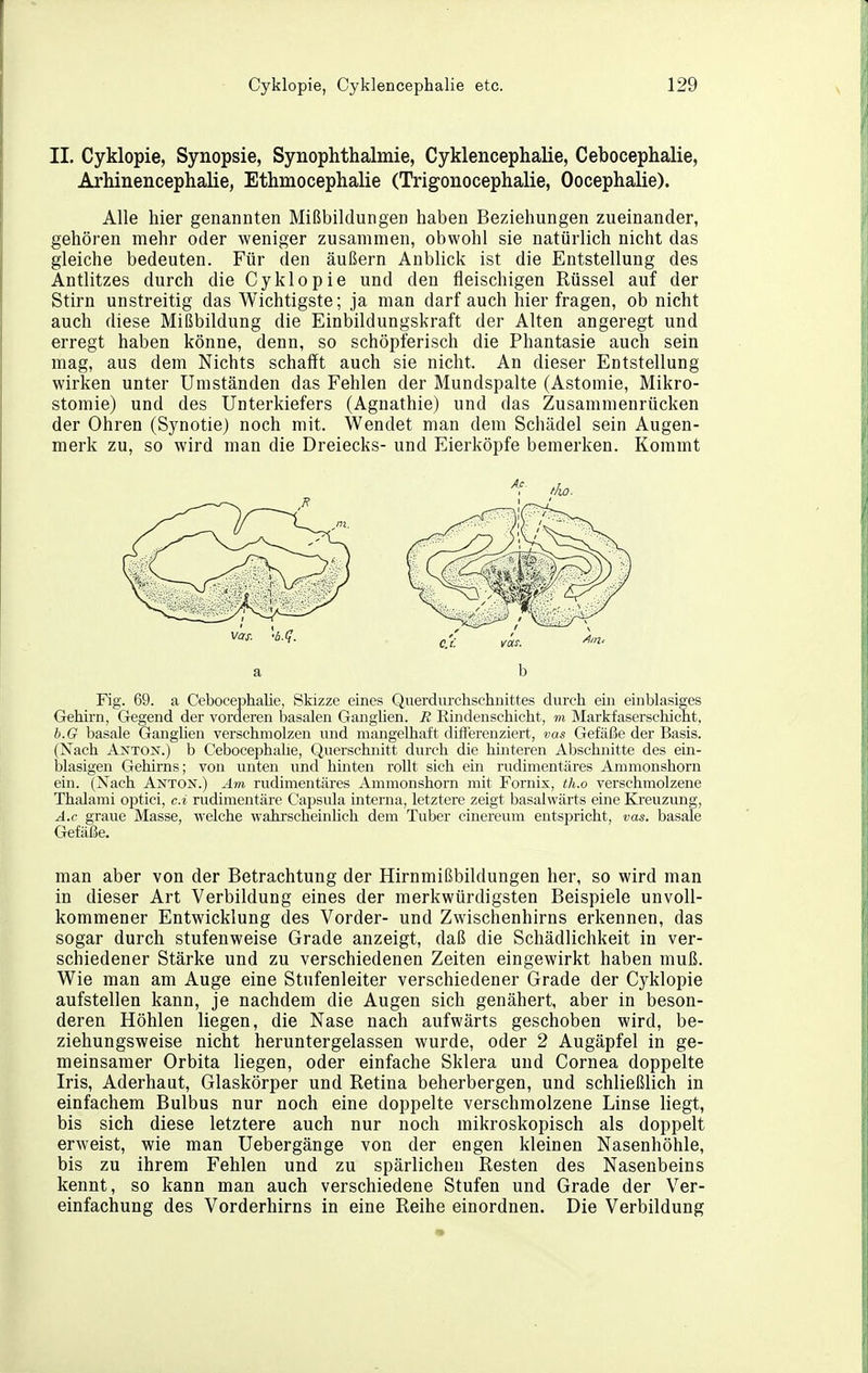 II. Cyklopie, Synopsie, Synophthalmie, Cyklencephalie, Cebocephalie, Arhinencephalie, Ethmocephalie (Trigonocephalie, Oocephalie). Alle hier genannten Mißbildungen haben Beziehungen zueinander, gehören mehr oder weniger zusammen, obwohl sie natürlich nicht das gleiche bedeuten. Für den äußern Anblick ist die Entstellung des Antlitzes durch die Cyklopie und den fleischigen Rüssel auf der Stirn unstreitig das Wichtigste; ja man darf auch hier fragen, ob nicht auch diese Mißbildung die Einbildungskraft der Alten angeregt und erregt haben könne, denn, so schöpferisch die Phantasie auch sein mag, aus dem Nichts schafft auch sie nicht. An dieser Entstellung wirken unter Umständen das Fehlen der Mundspalte (Astomie, Mikro- stomie) und des Unterkiefers (Agnathie) und das Zusammenrücken der Ohren (Synotie) noch mit. Wendet man dem Schädel sein Augen- merk zu, so wird man die Dreiecks- und Eierköpfe bemerken. Koramt Fig. 69. a Cebocephalie, Skizze eines Querdixrchschnittes durch em einblasiges Gehirn, Gegend der vorderen basalen GangUen. E Eindenschicht, m Markfaserschicht, b.G basale Ganglien verschmolzen und mangelhaft diflerenziert, vas Gefäße der Basis. (Nach Anton.) b Cebocephalie, Querschnitt durch die hmteren Abschnitte des etn- blasigen Gehirns; von unten und hinten roUt sich ein rudimentäres Ammonshorn ein. (Xach Anton.) Am rudimentäres Ammonshorn mit Fornix, th.o verschmolzene Thalami optici, c.i rudimentäre Capsula interna, letztere zeigt basalwärts eine Ki'euzung, A.c graue Masse, welche wahrscheinhch dem Tuber cinereum entspricht, vas. basale man aber von der Betrachtung der Hirnmißbildungen her, so wird man in dieser Art Verbildung eines der merkwürdigsten Beispiele unvoll- kommener Entwicklung des Vorder- und Zwischenhirns erkennen, das sogar durch stufenweise Grade anzeigt, daß die Schädlichkeit in ver- schiedener Stärke und zu verschiedenen Zeiten eingewirkt haben muß. Wie man am Auge eine Stufenleiter verschiedener Grade der Cyklopie aufstellen kann, je nachdem die Augen sich genähert, aber in beson- deren Höhlen liegen, die Nase nach aufwärts geschoben wird, be- ziehungsweise nicht heruntergelassen wurde, oder 2 Augäpfel in ge- meinsamer Orbita liegen, oder einfache Sklera und Cornea doppelte Iris, Aderhaut, Glaskörper und Retina beherbergen, und schließlich in einfachem Bulbus nur noch eine doppelte verschmolzene Linse liegt, bis sich diese letztere auch nur noch mikroskopisch als doppelt erweist, wie man Uebergänge von der engen kleinen Nasenhöhle, bis zu ihrem Fehlen und zu spärlichen Resten des Nasenbeins kennt, so kann man auch verschiedene Stufen und Grade der Ver- einfachung des Vorderhirns in eine Reihe einordnen. Die Verbildung a b Gefäße.