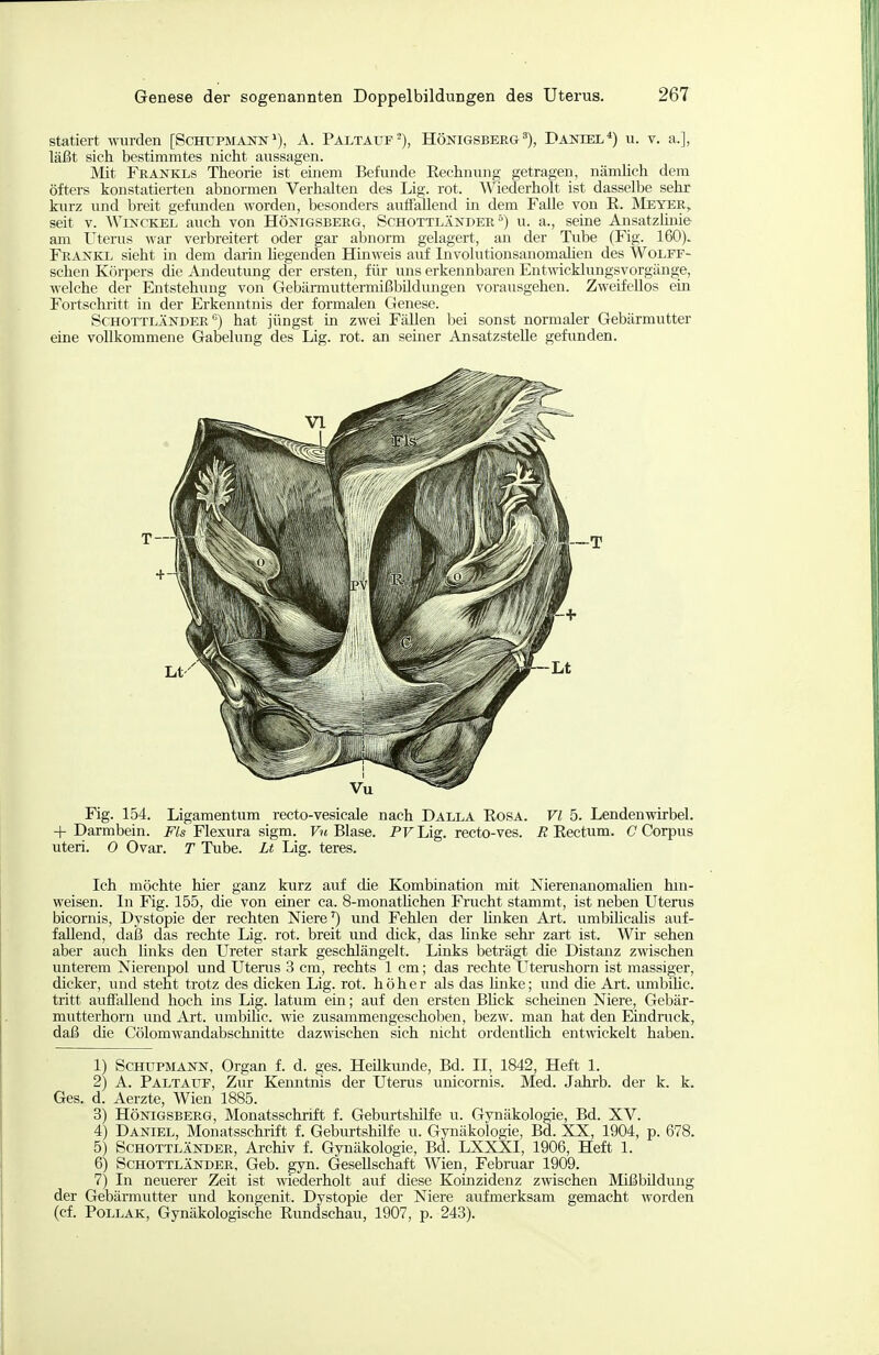 statiert wurden [SchtjpmannA. Paltauf-), HönigsbergDaniel*) u. v. a.], läßt sich bestimmtes nicht aussagen. Mit Frankls Theorie ist einem Befunde Rechnung getragen, nämlich dem öfters konstatierten abnormen Verhalten des Lig. rot. Wiederholt ist dasselbe sehr kurz und breit gefimden worden, besonders auffallend in dem Falle von R. Meyer, seit V. AVinckel auch von Hönigsberg, Schottländer °) u. a., seine AnsatzUnie am Uterus war verbreitert oder gar abnorm gelagert, an der Tube (Fig. 160). FrAjSTkl sieht in dem darin hegenden Hinweis auf Involutionsanomaheu des Wolff- schen Körpers die Andeutung der ersten, für uns erkennbaren Entwicklungsvorgänge, welche der Entstehung von Gebärmuttermißbildungen vorausgehen. Zweifellos ein Fortschritt in der Erkenntnis der formalen Genese. Schottländer °) hat jüngst in zwei Fällen bei sonst normaler Gebärmutter eine vollkommene Gabelung des Lig. rot. an seiner Ansatzstelle gefunden. Fig. 154. Ligamentum recto-vesicale nach Dalla Rosa. VI 5. Lendenwirbel. + Darmbein. Flexura sigm. F?« Blase. PF Lig. recto-ves. Ä Rectum. C Corpus uteri. 0 Ovar. T Tube. Lt Lig. teres. Ich möchte hier ganz kurz auf die Kombination mit Nierenanomahen hin- weisen. In Fig. 155, die von einer ca. 8-monathchen Frucht stammt, ist neben Uterus bicornis, Dystopie der rechten Niere') und Fehlen der linken Art. umbihcaHs auf- fallend, daß das rechte Lig. rot. breit und dick, das hnke sehr- zart ist. Wir sehen aber auch links den Ureter stark geschlängelt. Liaks beträgt die Distanz zwischen unterem Nierenpol und Uterus 3 cm, rechts 1 cm; das rechte Utenishorn ist massiger, dicker, und steht trotz des dicken Lig. rot. höher als das hnke; und die Art. timbiUc. tritt aufiallend hoch ins Lig. latum ein; auf den ersten Bhck scheinen Niere, Gebär- mutterhorn und Art. urabUic. wie zusammengeschoben, bezw. man hat den Eindruck, daß die Cölomwandabschnitte dazwischen sich nicht ordenthch entwickelt haben. 1) ScHUPMANN, Organ f. d. ges. Heilkunde, Bd. II, 1842, Heft 1. 2) A. Paltatif, Zur Kenntnis der Uterus unicornis. Med. Jahrb. der k. k. Ges. d. Aerzte, Wien 1885. 3) Hönigsberg, Monatsschrift f. Geburtshilfe u. Gynäkologie, Bd. XV. 4) Daniel, Monatsschrift f. Gebiu-tshilfe u. Gynäkologie, Bd. XX, 1904, p. 678. 5) Schottländer, Archiv f. Gynäkologie, Bd. LXXXI, 1906, Heft 1. 6) Schottländer, Geb. gyn. Gesellschaft Wien, Februar 1909. 7) In neuerer Zeit ist wiederholt auf diese Koinzidenz zwischen Mißbildung der Gebärmutter und kongenit. Dystopie der Niere aufmerksam gemacht worden (cf. PoLLAK, Gynäkologische Rundschau, 1907, p. 243).