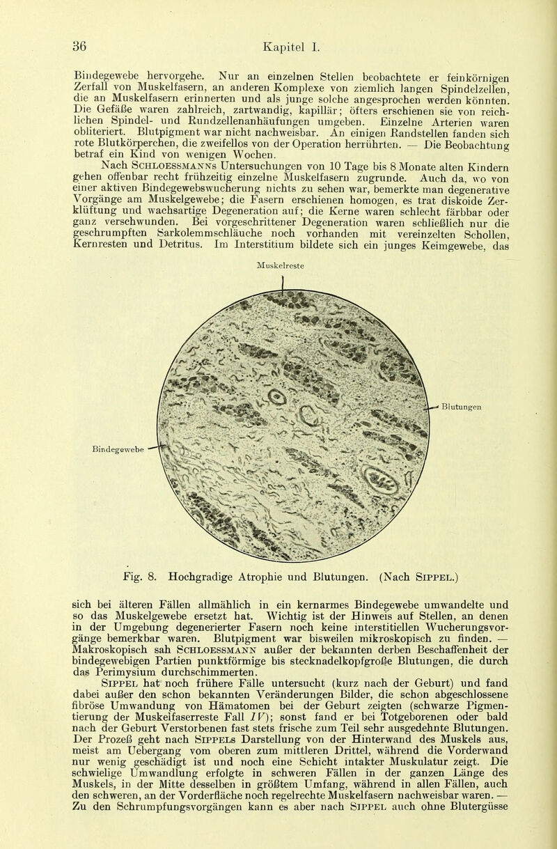 Bindegewebe hervorgehe. Nur an einzelnen Stellen beobachtete er feinkörnigen Zerfall von Muskelfasern, an anderen Komplexe von ziemlich langen Spindelzellen, die an Muskelfasern erinnerten und als junge solche angesprochen werden könnten! Die Gefäße waren zahlreich, zartwandig, kapillär; öfters erschienen sie von reich- lichen Spindel- und Rundzellenanhäufungen umgeben. Einzelne Arterien waren obliteriert. Blutpigment war nicht nachweisbar. An einigen Randstellen fanden sich rote Blutkörperchen, die zweifellos von der Operation herrührten. — Die Beobachtung betraf ein Kind von wenigen Wochen. Nach Schloessmannts Untersuchungen von 10 Tage bis 8 Monate alten Kindern gehen offenbar recht frühzeitig einzelne Muskelfasern zugrunde. Auch da, wo von einer aktiven Bindegewebswucherung nichts zu sehen war, bemerkte man degenerative Vorgänge am Muskelgewebe; die Fasern erschienen homogen, es trat diskoide Zer- klüftung und wachsartige Degeneration auf; die Kerne waren schlecht färbbar oder ganz verschwunden. Bei vorgeschrittener Degeneration waren schließlich nur die geschrumpften Sarkolemmschlauche noch vorhanden mit vereinzelten Schollen, Kernresten und Detritus. Im Interstitium bildete sich ein junges Keimgewebe, das Muskelreste Bindegewebe Blutungen Fig. 8. Hochgradige Atrophie und Blutungen. (Nach Sippel.) sich bei älteren Fällen allmählich in ein kernarmes Bindegewebe umwandelte und so das Muskelgewebe ersetzt hat. Wichtig ist der Hinweis auf Stellen, an denen in der Umgebung degenerierter Fasern noch keine interstitiellen Wucherungsvor- gänge bemerkbar waren. Blutpigment war bisweilen mikroskopisch zu finden. — Makroskopisch sah Schloessmann außer der bekannten derben Beschaffenheit der bindegewebigen Partien punktförmige bis stecknadelkopfgroße Blutungen, die durch das Perimysium durchschimmerten. Sippel hat noch frühere Fälle untersucht (kurz nach der Geburt) und fand dabei außer den schon bekannten Veränderungen Bilder, die schon abgeschlossene fibröse Umwandung von Hämatomen bei der Geburt zeigten (schwarze Pigmen- tierung der Muskeifaserreste Fall IV); sonst fand er bei Totgeborenen oder bald nach der Geburt Verstorbenen fast stets frische zum Teil sehr ausgedehnte Blutungen. Der Prozeß geht nach Sippels Darstellung von der Hinterwand des Muskels aus, meist am Uebergang vom oberen zum mittleren Drittel, während die Vorderwand nur wenig geschädigt ist und noch eine Schicht intakter Muskulatur zeigt. Die schwielige Umwandlung erfolgte in schweren Fällen in der ganzen Länge des Muskels, in der Mitte desselben in größtem Umfang, während in allen Fällen, auch den schweren, an der Vorderfläche noch regelrechte Muskelfasern nachweisbar waren. — Zu den Schrumpfungsvorgängen kann es aber nach Sippel auch ohne Blutergüsse