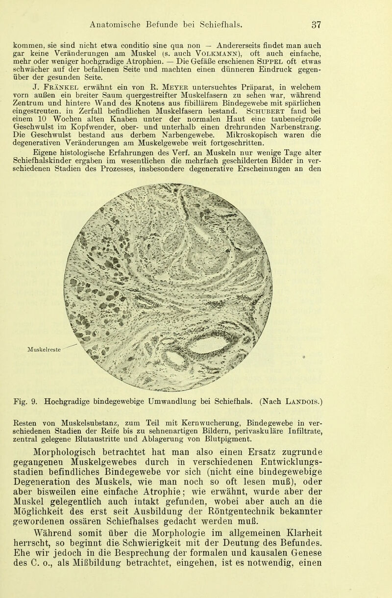 kommen, sie sind nicht etwa conditio sine qua non — Andererseits findet man auch gar keine Veränderungen am Muskel (s. auch Volkmann), oft auch einfache, mehr oder weniger hochgradige Atrophien. — Die Gefäße erschienen Sippel oft etwas schwächer auf der befallenen Seite und machten einen dünneren Eindruck gegen- über der gesunden Seite. J. Frankel erwähnt ein von R. Meyer untersuchtes Präparat, in welchem vorn außen ein breiter Saum quergestreifter Muskelfasern zu sehen war, während Zentrum und hintere Wand des Knotens aus fibillärem Bindegewebe mit spärlichen eingestreuten, in Zerfall befindlichen Muskelfasern bestand. Schubert fand bei einem 10 Wochen alten Knaben unter der normalen Haut eine taubeneigroße Geschwulst im Kopf wen der, ober- und unterhalb einen drehrunden Narbenstrang. Die Geschwulst bestand aus derbem Narbengewebe. Mikroskopisch waren die degenerativen Veränderungen am Muskelgewebe weit fortgeschritten. Eigene histologische Erfahrungen des Verf. an Muskeln nur wenige Tage alter Schiefhalskinder ergaben im wesentlichen die mehrfach geschilderten Bilder in ver- schiedenen Stadien des Prozesses, insbesondere degenerative Erscheinungen an den Muskelreste Fig. 9. Hochgradige bindegewebige Umwandlung bei Schiefhals. (Nach Landois.) Resten von Muskelsubstanz, zum Teil mit Kern Wucherung, Bindegewebe in ver- schiedenen Stadien der Reife bis zu sehnenartigen Bildern, perivaskuläre Infiltrate, zentral gelegene Blutaustritte und Ablagerung von Blutpigment. Morphologisch betrachtet hat man also einen Ersatz zugrunde gegangenen Muskelgewebes durch in verschiedenen Entwicklungs- stadien befindliches Bindegewebe vor sich (nicht eine bindegewebige Degeneration des Muskels, wie man noch so oft lesen muß), oder aber bisweilen eine einfache Atrophie; wie erwähnt, wurde aber der Muskel gelegentlich auch intakt gefunden, wobei aber auch an die Möglichkeit des erst seit Ausbildung der Röntgentechnik bekannter gewordenen ossären Schiefhalses gedacht werden muß. Während somit über die Morphologie im allgemeinen Klarheit herrscht, so beginnt die- Schwierigkeit mit der Deutung des Befundes. Ehe wir jedoch in die Besprechung der formalen und kausalen Genese des C. o., als Mißbildung betrachtet, eingehen, ist es notwendig, einen