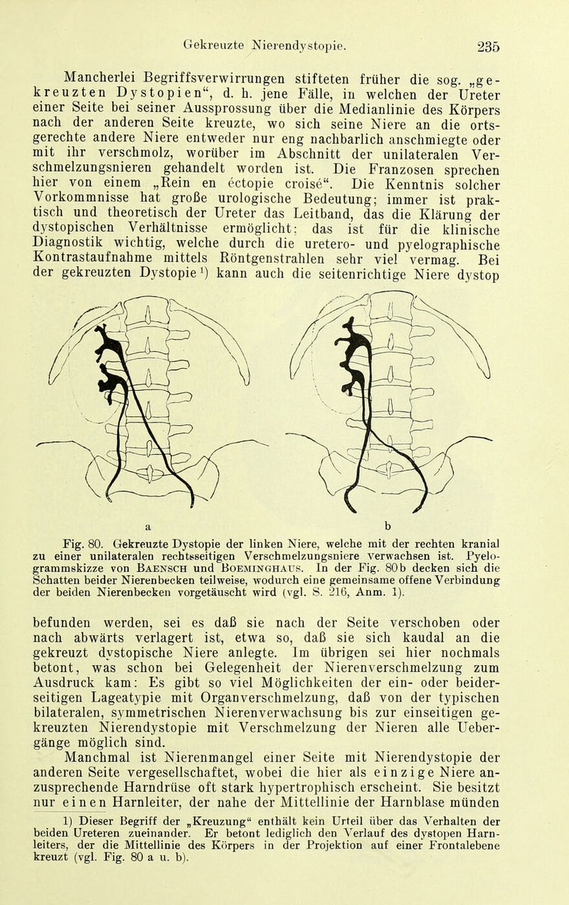Mancherlei Begriffsverwirrungen stifteten früher die sog. „ge- kreuzten Dystopien, d. h. jene Fälle, in welchen der Ureter einer Seite bei seiner Aussprossung über die Medianlinie des Körpers nach der anderen Seite kreuzte, wo sich seine Niere an die orts- gerechte andere Niere entweder nur eng nachbarlich anschmiegte oder mit ihr verschmolz, worüber im Abschnitt der unilateralen Ver- schmelzungsnieren gehandelt worden ist. Die Franzosen sprechen hier von einem „Rein en ectopie croise. Die Kenntnis solcher Vorkommnisse hat große urologische Bedeutung; immer ist prak- tisch und theoretisch der Ureter das Leitband, das die Klärung der dystopischen Verhältnisse ermöglicht: das ist für die klinische Diagnostik wichtig, welche durch die uretero- und pyelographische Kontrastaufnahme mittels Röntgenstrahlen sehr viel vermag. Bei der gekreuzten Dystopie') kann auch die seitenrichtige Niere dystop Fig. 80. Gekreuzte Dystopie der linken Niere, welche mit der rechten kranial zu einer unilateralen rechtsseitigen Verschmelzungsniere verwachsen ist. Pyelo- grammskizze von Baensch und Boeminghaus. In der Fig. 80 b decken sich die Schatten beider Nierenbecken teilweise, wodurch eine gemeinsame offene Verbindung der beiden Nierenbecken vorgetäuscht wird (vgl. S. 216, Anm. 1). befunden werden, sei es daß sie nach der Seite verschoben oder nach abwärts verlagert ist, etwa so, daß sie sich kaudal an die gekreuzt dystopische Niere anlegte. Im übrigen sei hier nochmals betont, was schon bei Gelegenheit der Nierenverschmelzung zum Ausdruck kam: Es gibt so viel Möglichkeiten der ein- oder beider- seitigen Lageatypie mit Orgauverschmelzung, daß von der typischen bilateralen, symmetrischen Nierenverwachsung bis zur einseitigen ge- kreuzten Nierendystopie mit Verschmelzung der Nieren alle Ueber- gänge möglich sind. Manchmal ist Nierenmangel einer Seite mit Nierendystopie der anderen Seite vergesellschaftet, wobei die hier als einzige Niere an- zusprechende Harndrüse oft stark hypertrophisch erscheint. Sie besitzt nur einen Harnleiter, der nahe der Mittellinie der Harnblase münden 1) Dieser Begriff der „Kreuzung enthält kein Urteil über das Verhalten der beiden Ureteren zueinander. Er betont lediglich den Verlauf des dystopen Harn- leiters, der die Mittellinie des Körpers in der Projektion auf einer Frontalebene kreuzt (vgl. Fig. 80 a u. b).