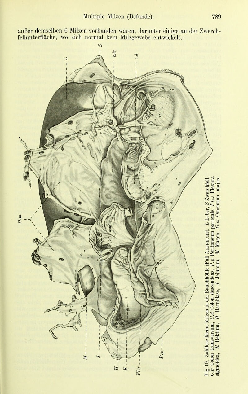 außer demselben 6 Milzen vorhanden waren, darunter einige an der Zwerch- fellunterfläche, wo sich normal kein Milzgewebe entwickelt.