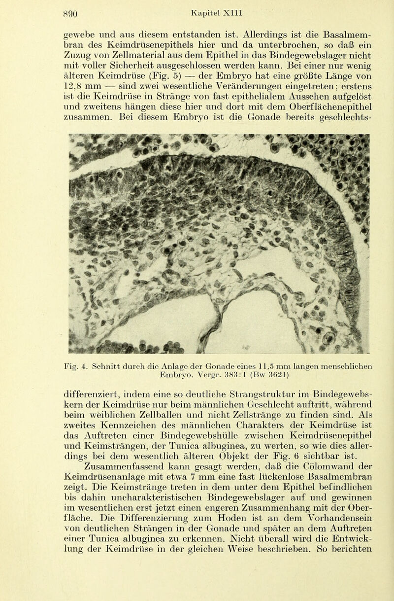 gewebe und aus diesem entstanden ist. Allerdings ist die Basalmem- bran des Keimdrüsenepithels hier und da unterbrochen, so daß ein Zuzug von Zellmaterial aus dem Epithel in das Bindegewebslager nicht mit voller Sicherheit ausgeschlossen werden kann. Bei einer nur wenig älteren Keimdrüse (Fig. 5) — der Embryo hat eine größte Länge von 12,8 mm — sind zwei wesentliche Veränderungen eingetreten; erstens ist die Keimdrüse in Stränge von fast epithelialem Aussehen aufgelöst und zweitens hängen diese hier und dort mit dem Oberflächenepithel zusammen. Bei diesem Embryo ist die Gonade bereits geschlechts- Fig. 4. Schnitt durch die Anlage der Gonade eines 11,5 mm langen menschlichen Embryo. Vergr. 383:1 (Bw 3621) differenziert, indem eine so deutliche Strangstruktur im Bindegewebs- kern der Keimdrüse nur beim männlichen Geschlecht auftritt, während beim weiblichen Zellballen und nicht Zellstränge zu finden sind. Als zweites Kennzeichen des männlichen Charakters der Keimdrüse ist das Auftreten einer Bindegewebshülle zwischen Keimdrüsenepithel und Keimsträngen, der Tunica albuginea, zu werten, so wie dies aller- dings bei dem wesentlich älteren Objekt der Fig. 6 sichtbar ist. Zusammenfassend kann gesagt werden, daß die Cölomwand der Keimdrüsenanlage mit etwa 7 mm eine fast lückenlose Basalmembran zeigt. Die Keimstränge treten in dem unter dem Epithel befindlichen bis dahin uncharakteristischen Bindegewebslager auf und gewinnen im wesentlichen erst jetzt einen engeren Zusammenhang mit der Ober- fläche. Die Differenzierung zum Hoden ist an dem Vorhandensein von deutlichen Strängen in der Gonade und später an dem Auftreten einer Tunica albuginea zu erkennen. Nicht überall wird die Entwick- lung der Keimdrüse in der gleichen Weise beschrieben. So berichten