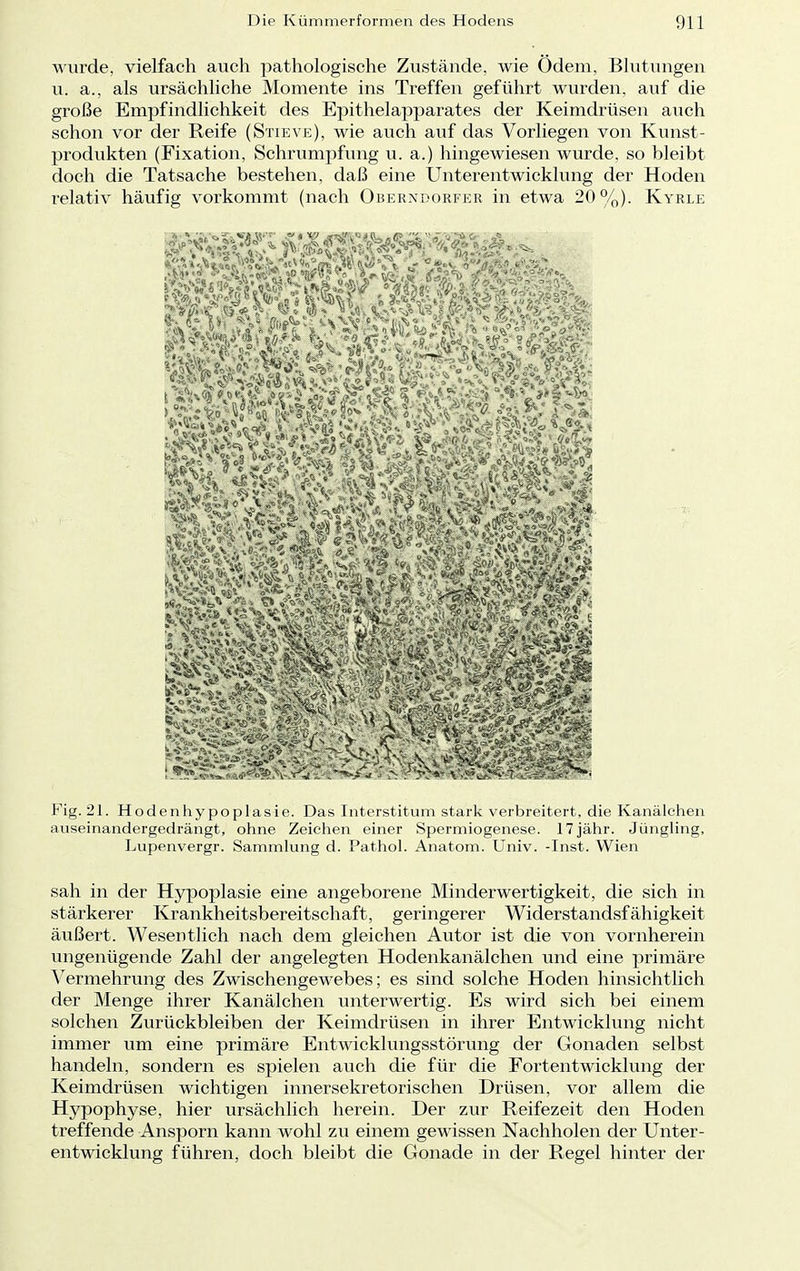 wurde, vielfach auch pathologische Zustände, wie Ödem, Blutungen u. a., als ursächliche Momente ins Treffen geführt wurden, auf die große Empfindlichkeit des Epithelapparates der Keimdrüsen auch schon vor der Reife (Stieve), wie auch auf das Vorliegen von Kunst- produkten (Fixation, Schrumpfung u. a.) hingewiesen wurde, so bleibt doch die Tatsache bestehen, daß eine Unterentwicklung der Hoden relativ häufig vorkommt (nach Oberndorfer in etwa 20%). Kyrle $?0- rag Fig. 21. Hoden Hypoplasie. Das Interstitüm stark verbreitert, die Kanälchen auseinandergedrängt, ohne Zeichen einer Spermiogenese. 17jähr. Jüngling, Lupenvergr. Sammlung d. Pathol. Anatom. Univ. -Inst. Wien sah in der Hypoplasie eine angeborene Minderwertigkeit, die sich in stärkerer Krankheitsbereitschaft, geringerer Widerstandsfähigkeit ätißert. Wesentlich nach dem gleichen Autor ist die von vornherein ungenügende Zahl der angelegten Hodenkanälchen und eine primäre Vermehrung des Zwischengewebes; es sind solche Hoden hinsichtlich der Menge ihrer Kanälchen unterwertig. Es wird sich bei einem solchen Zurückbleiben der Keimdrüsen in ihrer Entwicklung nicht immer um eine primäre Entwicklungsstörung der Gonaden selbst handeln, sondern es spielen auch die für die Fortentwicklung der Keimdrüsen wichtigen innersekretorischen Drüsen, vor allem die Hypophyse, hier ursächlich herein. Der zur Reifezeit den Hoden treffende Ansporn kann wohl zu einem gewissen Nachholen der Unter- entwicklung führen, doch bleibt die Gonade in der Regel hinter der