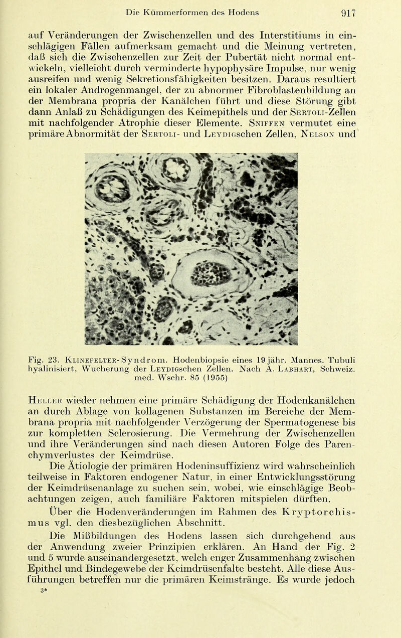 auf Veränderungen der Zwischenzellen und des Interstitiums in ein- schlägigen Fällen aufmerksam gemacht und die Meinung vertreten, daß sich die Zwischenzellen zur Zeit der Pubertät nicht normal ent- wickeln, vielleicht durch verminderte hypophysäre Impulse, nur wenig ausreifen und wenig Sekretionsfähigkeiten besitzen. Daraus resultiert ein lokaler Androgenmangel, der zu abnormer Fibroblastenbildung an der Membrana propria der Kanälchen führt und diese Störung gibt dann Anlaß zu Schädigungen des Keimepithels und der Sertoli-Zellen mit nachfolgender Atrophie dieser Elemente. Sniffen vermutet eine primäre Abnormität der Sertoli- und LEYDicschen Zellen, Nelson und Fig. 23. Klinefelter-Syndrom. Hodenbiopsie eines 19 jähr. Mannes. Tubuli hyalinisiert, Wucherung der LEYDiGschen Zellen. Nach A. Labhart, Schweiz, med. Wschr. 85 (1955) Heller wieder nehmen eine primäre Schädigung der Hodenkanälchen an durch Ablage von kollagenen Substanzen im Bereiche der Mem- brana propria mit nachfolgender Verzögerung der Spermatogenese bis zur kompletten Sclerosierung. Die Vermehrung der Zwischenzellen und ihre Veränderungen sind nach diesen Autoren Folge des Paren- chymVerlustes der Keimdrüse. Die Ätiologie der primären Hodeninsuffizienz wird wahrscheinlich teilweise in Faktoren endogener Natur, in einer Entwicklungsstörung der Keimdrüsenanlage zu suchen sein, wobei, wie einschlägige Beob- achtungen zeigen, auch familiäre Faktoren mitspielen dürften. Über die Hodenveränderungen im Rahmen des Kryptorchis- mus vgl. den diesbezüglichen Abschnitt. Die Mißbildungen des Hodens lassen sich durchgehend aus der Anwendung zweier Prinzipien erklären. An Hand der Fig. 2 und 5 wurde auseinandergesetzt, welch enger Zusammenhang zwischen Epithel und Bindegewebe der Keimdrüsenfalte besteht. Alle diese Aus- führungen betreffen nur die primären Keimstränge. Es wurde jedoch 3*