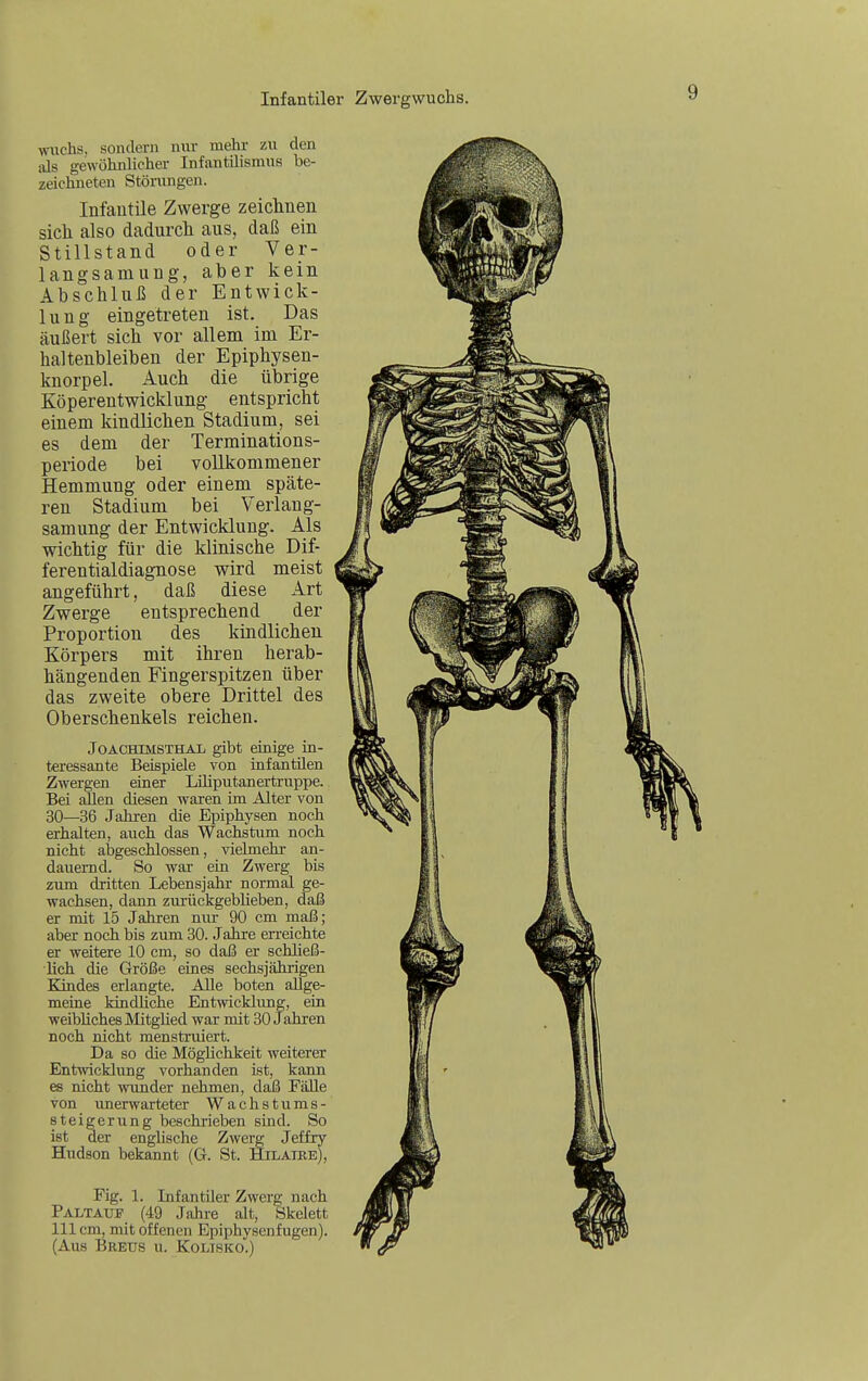 wuchs, sondern nur raehi- zu den als gewühnlicher Infantilismus be- zeichneten Störungen. Infantile Zwerge zeiclinen sich also dadurcli aus, daß ein Stillstand oder Ver- langsamung, aber kein Abschluß der Entwick- lung eingetreten ist. Das äußert sich vor allem im Er- haltenbleiben der Epiphysen- knorpel. Auch die übrige Köperentwicklung entspricht einem kindlichen Stadium, sei es dem der Terminations- periode bei vollkommener Hemmung oder einem späte- ren Stadium bei Verlang- samung der Entwicklung. Als wichtig für die klinische Dif- ferentialdiagnose wird meist angeführt, daß diese Art Zwerge entsprechend der Proportion des kindlichen Körpers mit ihren herab- hängenden Fingerspitzen über das zweite obere Drittel des Oberschenkels reichen. Joachimsthal gibt einige in- teressante Beispiele von infantilen Zwergen einer Liliputanertruppe. Bei fdlen diesen waren im Alter von 30—36 Jahren die Epiphysen noch erhalten, auch das Wachstum noch nicht abgeschlossen, vielmehr an- dauernd. So war ein Zwerg bis zum dritten Lebensjahr normal ge- wachsen, dann zurückgeblieben, daß er mit 15 Jahren niu- 90 cm maß; aber noch bis zum 30. Jahre erreichte er weitere 10 cm, so daß er schließ- lich die Größe eines sechsjährigen Kindes erlangte. Alle boten allge- meine kindhche Entmcklung, ein weibliches Mitglied war mit 30 Jahren noch nicht menstruiert. Da so die Möglichkeit weiterer Entwicklung vorhanden ist, kann es nicht wTinder nehmen, daß Fälle von unerwarteter Wachstums- steigerung beschrieben sind. So ist der englische Zwerg Jeffry Hudson bekannt (G. St. Hilatre), Fig. 1. Infantiler Zwerg nach Paltauf (49 Jahre alt, Skelett III cm, mit offenen Epiphysenfugen). (Aus Breüs u. Kolisko.)