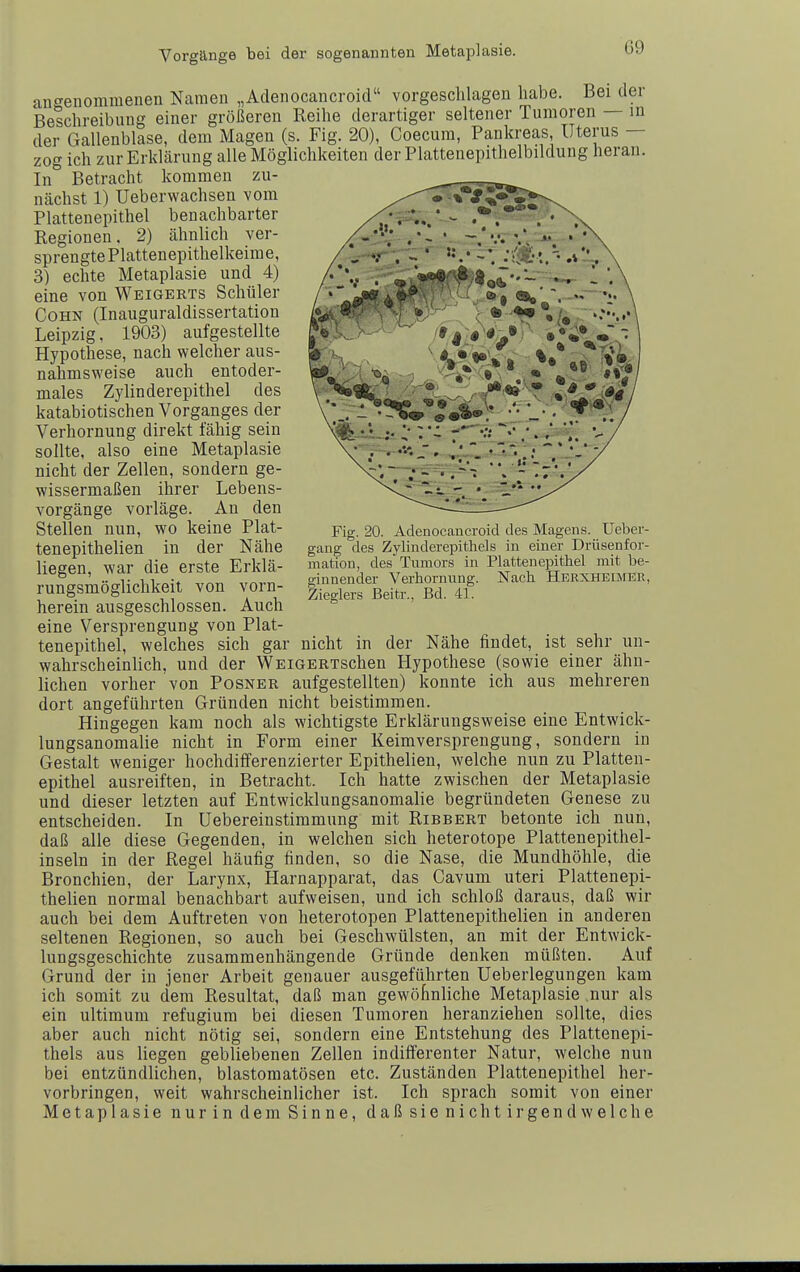 angenommenen Namen „Adenocancroicl vorgeschlagen habe. Bei der Beschreibung einer größeren Reihe derartiger seltener Tumoren — m der Gallenblase, dem Magen (s. Fig. 20), Coecura, Pankreas Uterus — zog ich zur Erklärung alle Möglichkeiten der Plattenepithelbildung heran. In° Betracht kommen zu- nächst 1) Ueberwachsen vom Plattenepithel benachbarter Regionen. 2) ähnlich ver- sprengte Plattenepithelkeime, 3) echte Metaplasie und 4) eine von Weigerts Schüler Cohn (Inauguraldissertation Leipzig. 1903) aufgestellte Hypothese, nach welcher aus- nahmsweise auch entoder- males Zylinder epithel des katabiotischen Vorganges der Verhornung direkt fähig sein sollte, also eine Metaplasie nicht der Zellen, sondern ge- wissermaßen ihrer Lebens- vorgänge vorläge. An den Stellen nun, wo keine Plat- tenepithelien in der Nähe liegen, war die erste Erklä- rungsmöglichkeit von vorn- herein ausgeschlossen. Auch eine Versprengung von Plat- tenepithel, welches sich gar nicht in der Nähe findet, ist sehr un- wahrscheinlich, und der WEiGERTSchen Hypothese (sowie einer ähn- lichen vorher von Posner aufgestellten) konnte ich aus mehreren dort angeführten Gründen nicht beistimmen. Hingegen kam noch als wichtigste Erklärungsweise eine Entwick- lungsanomalie nicht in Form einer Keimversprengung, sondern in Gestalt weniger hochdifferenzierter Epithelien, welche nun zu Platten- epithel ausreiften, in Betracht. Ich hatte zwischen der Metaplasie und dieser letzten auf Entwicklungsanomalie begründeten Genese zu entscheiden. In Uebereinstimmung mit Ribbert betonte ich nun, daß alle diese Gegenden, in welchen sich heterotope Plattenepithel- inseln in der Regel häufig finden, so die Nase, die Mundhöhle, die Bronchien, der Larynx, Harnapparat, das Cavum uteri Plattenepi- thelien normal benachbart aufweisen, und ich schloß daraus, daß wir auch bei dem Auftreten von heterotopen Plattenepithelien in anderen seltenen Regionen, so auch bei Geschwülsten, an mit der Entwick- lungsgeschichte zusammenhängende Gründe denken müßten. Auf Grund der in jener Arbeit genauer ausgeführten Ueberlegungen kam ich somit zu dem Resultat, daß man gewöhnliche Metaplasie .nur als ein ultimum refugium bei diesen Tumoren heranziehen sollte, dies aber auch nicht nötig sei, sondern eine Entstehung des Plattenepi- thels aus liegen gebliebenen Zellen indifferenter Natur, welche nun bei entzündlichen, blastomatösen etc. Zuständen Plattenepithel her- vorbringen, weit wahrscheinlicher ist. Ich sprach somit von einer Metaplasie nurin dem Sinne, daß sienichtirgendwelche Fig. 20. Adenocancroid des Magens. Ueber- gang des Zylinderepithels in einer Drüsenfor- mation, des Tumors in Platten epithel mit be- ginnender Verhornung. Nach Herxheimek, Zieglers Beitr., Bd. 41.