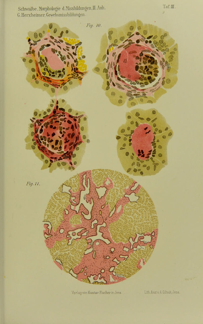 Schwalbe, Morpliologie d.Missliildiinöcii,III Aull. G.Ilerxheimei'. GcwebsinissbihkingLMi.