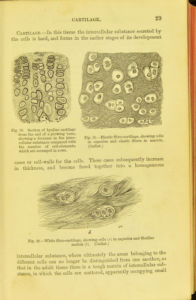 CARTILAGE. Caktilage.—In this tissue the intercellular substance secreted hj the cells is hard, and forms in the earlier stages of its development ^^0 o rig. 30. Section of hyaline cartilage ■ from the end of a growing bone, sho-wiag a decrease in the inter- celltdar substance compared with the number of cell-elements, ■which are arranged in rows. Pig. 31.—Elastic flbro-cai-tUage, showing cells in capsules and elastic fibres in matrix. (Cadiat.) cases or ceU-walls for the cells. These cases subsequently increase iu thiclmess, and become fused together into a homogeneous Kg. 32.-WMte flbro-cartilage, showing cells [a] in capsules and fibrillar matrix (6). (Cadiat.) interceUular substance, where ultimately the areas belonging to the different ceUs can no longer be distinguished from one another so that in the adult tissue there is a tough matrix of intercellular sub- stance, in which the cells are scattered, apparently occupying smau