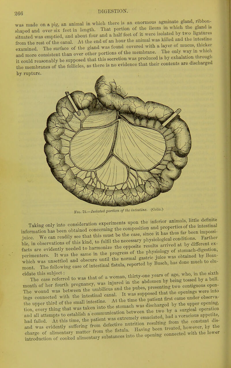 was made on a pig, an animal in wMcli there is an enormous agminate gland, ribbo..- sTaped and over feet in length. Tlmt portion of the ileum m which the gland tuated was emptied, and about four and a half feet of it were isola ed by two hgature^ from the rest of the canal. At the end of an hour the annual was killed and the .ntestu c examined. The surface of the gland was found covered with a ^^J-- and more consistent than over other portions of the membrane The o^^^ ^^J^^ it could reasonably be supposed that this secretion was produced is by exhalation through thrmembrars of-the follicles, as there is no evidence that their contents are discharged by rupture. Fia. ri.-Isolated portion of Hie intestine. (CoUu.) TaMng only into consideration experiments upon the ^^^^^ information has been obtained concernmg «°-P°f rae ttus for been impossi- Juice. We can readily see that this^^^^^^^^^^^^^ ^^^ther ble, in observations of this kind, to fulfil thenecessaiy i y b different ex- facls are evidently needed to harmonize J^^yll^^^ perimenters. It was the same in the progress ^^^tained by Beau- which was unsettled and obscure unti the ^^^^Z Z. much to el«- mont. The following case of intestmal fistula, reported by Buscb, cidate this subject: j „g ^-lio, iu the sixth The case referred to was that ot ^^^^^^^^'''^ZIZ^X tossed by a bull, month of her fourth pregnancy, was injured m ^J^^ f donien by J ^^^ The wound was ^f^^rT^l^ uZIs^^^^^^^ ings connected with the intestinal canal, it g ^ ^^der observa- th'e upper third of the small intestine, ^^^^^^^^^l^^^*;^^^^^^^^^ upper opening, tion, every thing that was taken into the stomach ^^^^^ ^ie two by a surgicd operation and all attempts to establish a commumcation between tlie tv. o y ^ ^ had failed. At this time, the patient ^^extremely emae a ed^^^^ ^.^ and was evidently suffering from ^f'f^;:;''''^ZnT^^^^ charge of alimentary matter from the fistula, naving been t , ^^^ ^^ introduction of cooked alimentary substances into the opening connec