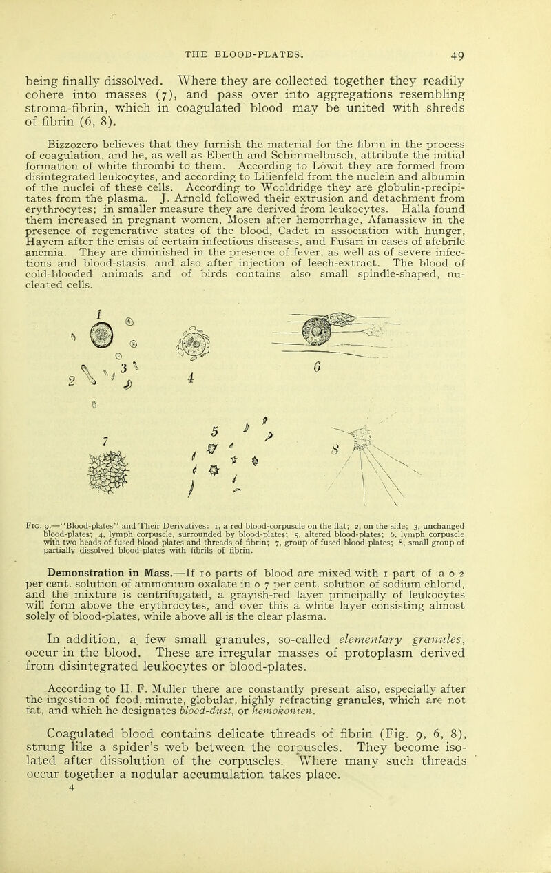 being finally dissolved. Where they are collected together they readily cohere into masses (7), and pass over into aggregations resembling stroma-fibrin, which in coagulated blood mav be united with shreds of fibrin (6, 8). Bizzozero believes that they furnish the material for the fibrin in the process of coagulation, and he, as well as Eberth and Schimmelbusch, attribute the initial formation of white thrombi to them. According to Lowit they are formed from disintegrated leukocytes, and according to Lilienfeld from the nuclein and albumin of the nuclei of these cells. According to Wooldridge they are globulin-precipi- tates from the plasma. J. Arnold followed their extrusion and detachment from erythrocytes; in smaller measure they are derived from leukocytes. Halla found them increased in pregnant women, Mosen after hemorrhage, Afanassiew in the presence of regenerative states of the blood, Cadet in association with hunger, Hayem after the crisis of certain infectious diseases, and Fusari in cases of afebrile anemia. They are diminished in the presence of fever, as well as of severe infec- tions and blood-stasis, and also after injection of leech-extract. The blood of cold-blooded animals and of birds contains also small spindle-shaped, nu- cleated cells. Fig. 9.—Blood-plates and Their Derivatives: i, a red blood-corpuscle on the fiat; 2, on the side; 3, unchanged blood-plates; 4, lymph corpuscle, surrounded by blood-plates; s, altered blood-plates; 6, lyraph corpuscle with two heads of fused blood-plates and threads of fibrin; 7, group of fused blood-plates; 8, small group of partially dissolved blood-plates with fibrils of fibrin. Demonstration in Mass.—If lo parts of blood are mixed with i part of a 0.2 per cent, solution of ammonium oxalate in 0.7 per cent, solution of sodium chlorid, and the mixture is centrifugated, a grayish-red layer principally of leukocytes will form above the erythrocytes, and over this a white layer consisting almost solely of blood-plates, while above all is the clear plasma. In addition, a. few small granules, so-called elementary granules, occur in the blood. These are irregular masses of protoplasm derived from disintegrated leukocytes or blood-plates. According to H. F. Miiller there are constantly present also, especially after the mgestion of food, minute, globular, highly refracting granules, which are not fat, and which he designates blood-dust, or hemokonien. Coagulated blood contains delicate threads of fibrin (Fig. 9, 6, 8), strung like a spider's web between the corpuscles. They become iso- lated after dissolution of the corpuscles. Where many such threads occur together a nodular accumulation takes place. 4
