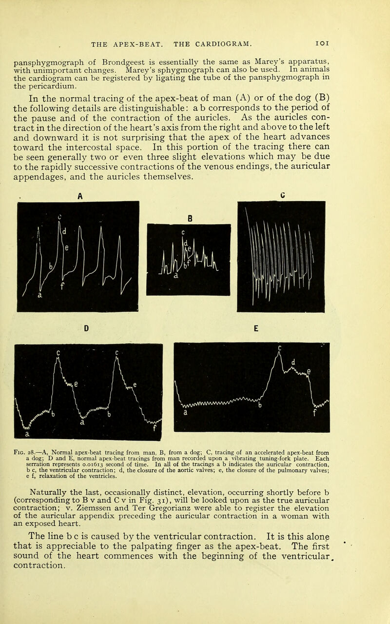 THE APEX-BEAT. THE CARDIOGRAM. lOI pansphygmograph of Brondgeest is essentially the same as Marey's apparatus, with unimportant changes. Marey's sphygmograph can also be used. In animals the cardiogram can be registered by ligating the tube of the pansphygmograph in the pericardium. In the normal tracing of the apex-beat of man (A) or of the dog (B) the following details are distinguishable: a b corresponds to the period of the pause and of the contraction of the auricles. As the auricles con- tract in the direction of the heart's axis from the right and above to the left and downward it is not surprising that the apex of the heart advances toward the intercostal space. In this portion of the tracing there can be seen generally two or even three slight elevations which may be due to the rapidly successive contractions of the venous endings, the auricular appendages, and the auricles themselves. Fig. 28.—A, Normal apex-beat tracing from man, B, from a dog; C, tracing of an accelerated apex-beat from a dog; D and E, normal apex-beat tracings from man recorded upon a vibrating tuning-fork plate. Each serration represents 0.01613 second of time. In all of the tracings a b indicates the auricular contraction, b c, the ventricular contraction; d, the closure of the aortic valves; e, the closure of the pulmonary valves; e f, relaxation of the ventricles. Naturally the last, occasionally distinct, elevation, occurring shortly before b (corresponding to B v and C v in Fig. 31), will be looked upon as the true auricular contraction; v. Ziemssen and Ter Gregorianz were able to register the elevation of the auricular appendix preceding the auricular contraction in a woman with an exposed heart. The line b c is caused by the ventricular contraction. It is this alone that is appreciable to the palpating finger as the apex-beat. The first ' • sound of the heart commences with the beginning of the ventricular, contraction.