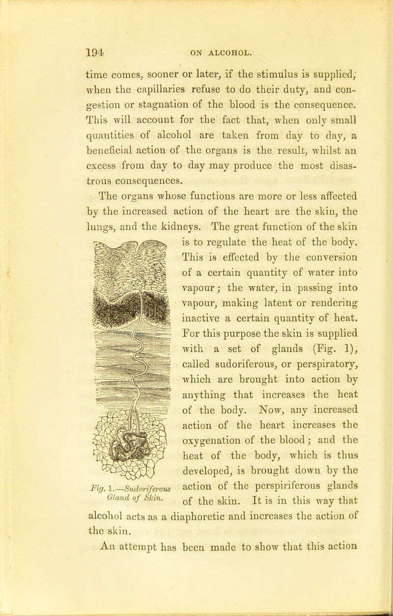 time comes, sooner or later, if the stimulus is supplied, whea the capillaries refuse to do their duty, and con- gestion or stagnation of the blood is the consequence. This will account for the fact that, when only small quantities of alcohol are taken from day to day, a beneficial action of the organs is the result, whilst an excess from day to day may produce the most disas- trous consequences. The organs whose functions are more or less aflFected by the increased action of the heart are the skin, the lungs, and the kidneys. The great function of the skin is to regulate the heat of the body. This is effected by the conA^ersion of a certain quantity of water into vapour; the water, in passing into vapour, making latent or rendering inactive a certain quantity of heat. For this purpose the skin is supplied with a set of glands (Fig. 1), called sudoriferous, or perspiratory, which are brought into action by anything that increases the heat of the body. Now, any increased action of the heart increases the oxygenation of the blood ; and the heat of the body, which is thus developed, is brought down by the action of the perspiriferous glands of the skin. It is in tliis way that alcohol acts as a diaphoretic and increases the action of the skin. An attempt has been made to show that this action Fig. 1.—Sudorifa'ous Gland of Shin.